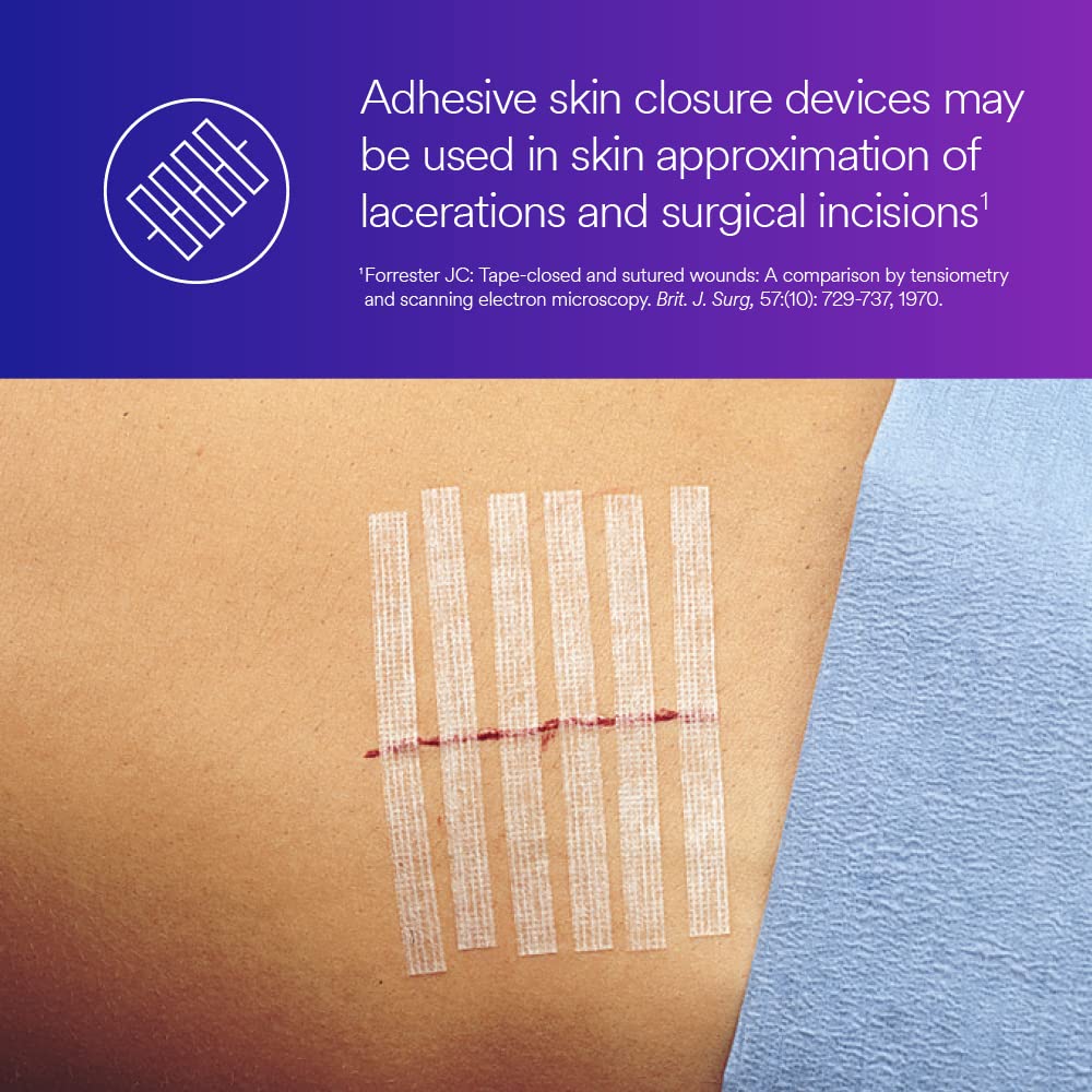 3M™ Steri-Strip™ Reinforced Adhesive Skin Closures, R1547, 1/2 in x 4 in (12 mm x 100 mm), 50 Bag/Carton, 4 Carton/Case - Image 5