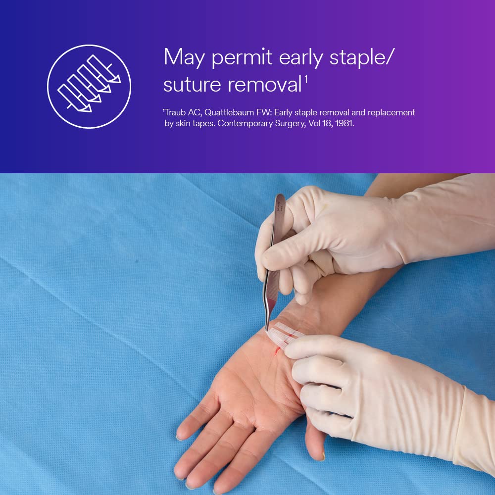 3M™ Steri-Strip™ Reinforced Adhesive Skin Closures, R1547, 1/2 in x 4 in (12 mm x 100 mm), 50 Bag/Carton, 4 Carton/Case - Image 6