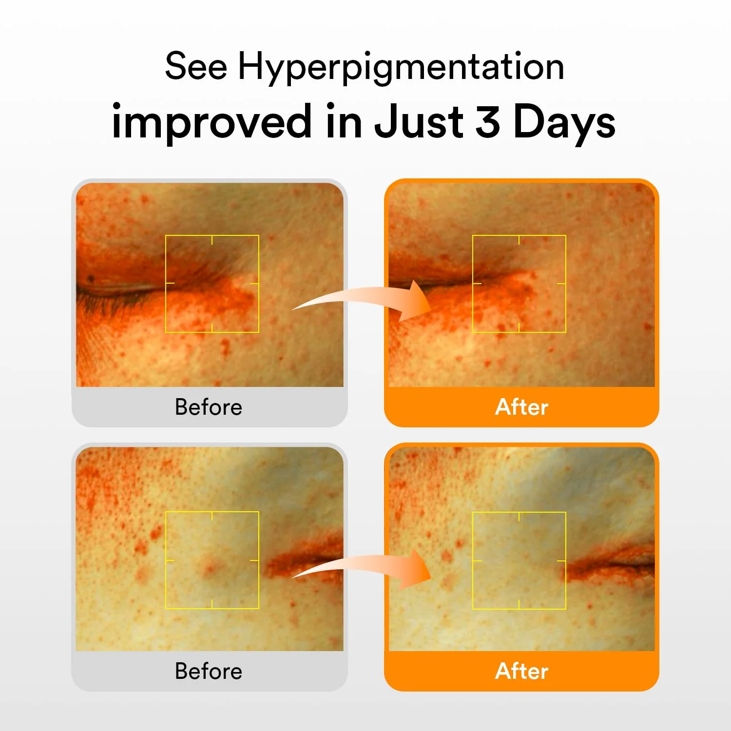 Abib Glutathiosome Dark Spot Serum Vita drop 1.69 fl.oz. | Korean Skincare, Dark Spot, Hyperpigmentation Treatment | Serum for Sensitive, Uneven Skin - Image 12