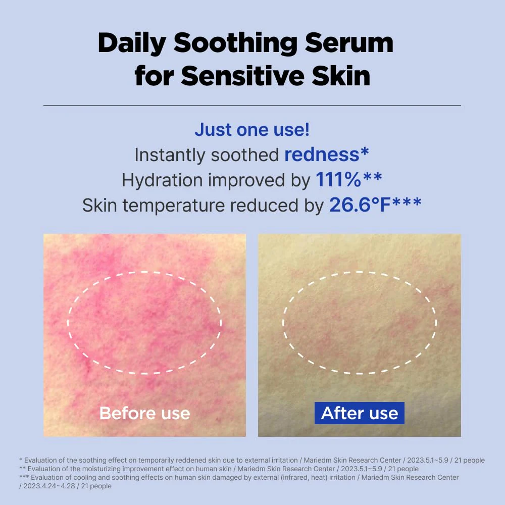 ACNI Dr. 1st Control Serum, Fast-Soothing Formula for Acne-Prone Skin, Non-Comedogenic Daily Serum for Oil-Water Balance, Korean Skin Care (1.35 fl.oz./40ml) - Image 9