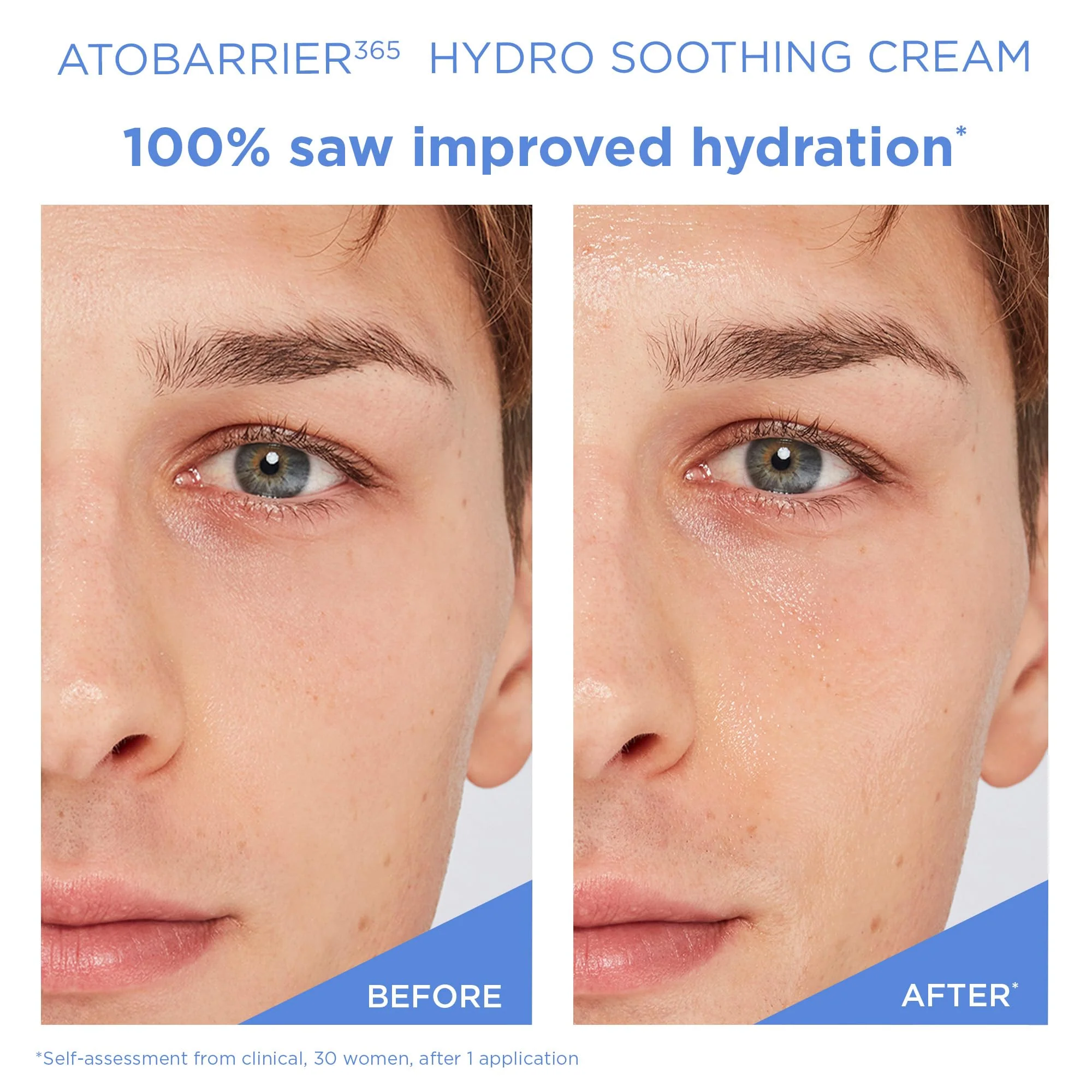 AESTURA ATOBARRIER365 Hydro Soothing Gel Cream Moisturizer with Ceramides for Moisture Barrier Repair | Lightweight Hydration, Instant Cooling, Suitable for Sensitive Skin, 60ML / 2.03 fl.oz. - Image 6