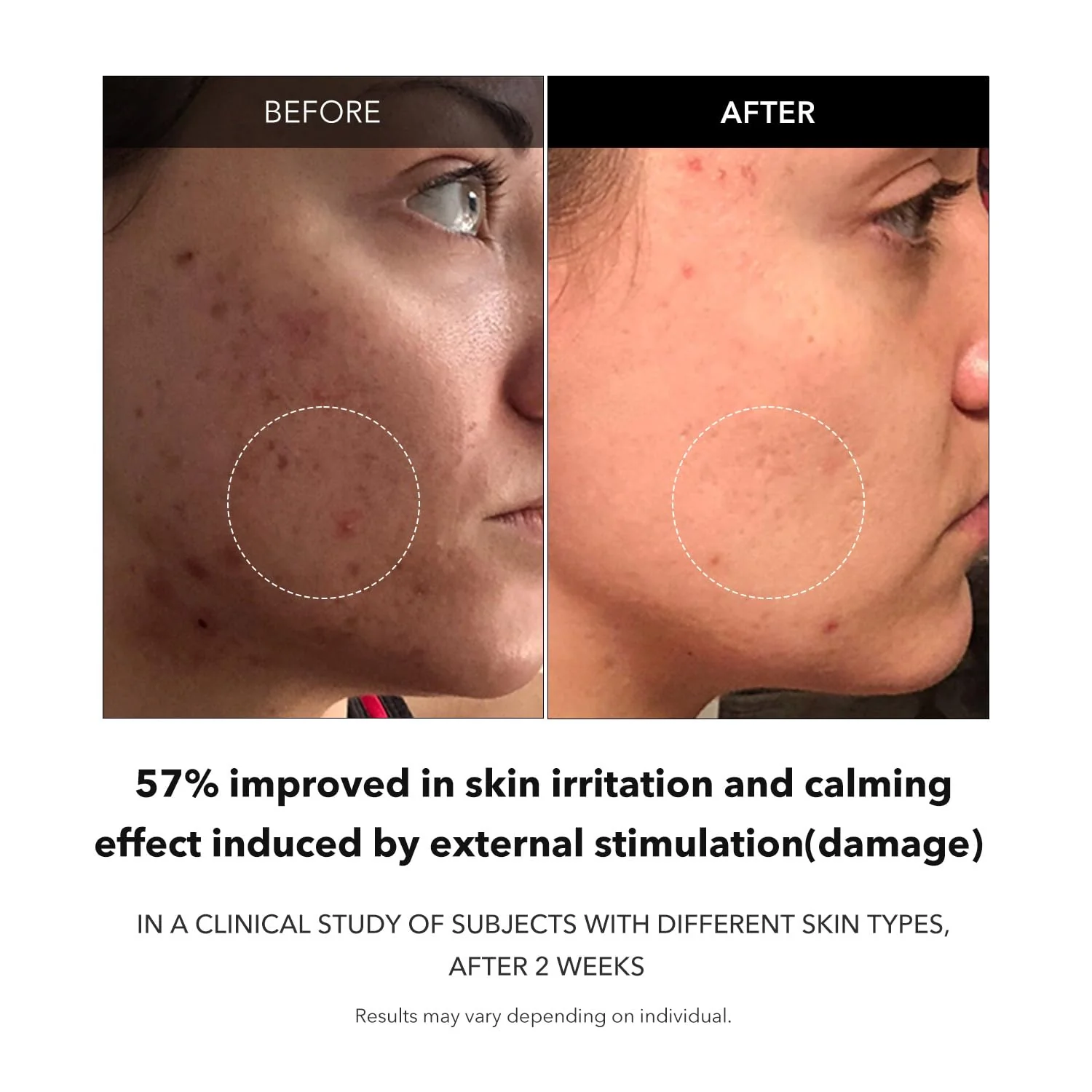 APRILSKIN Carrotene Clarifying Facial Serum | Vegan, Non-comedogenic | Blemish Clear, Dark Spot Corrector | Korea Skincare | Oily Skin, Sensitive Skin, Bumpy Skin | 1.25 fl.oz - Image 6