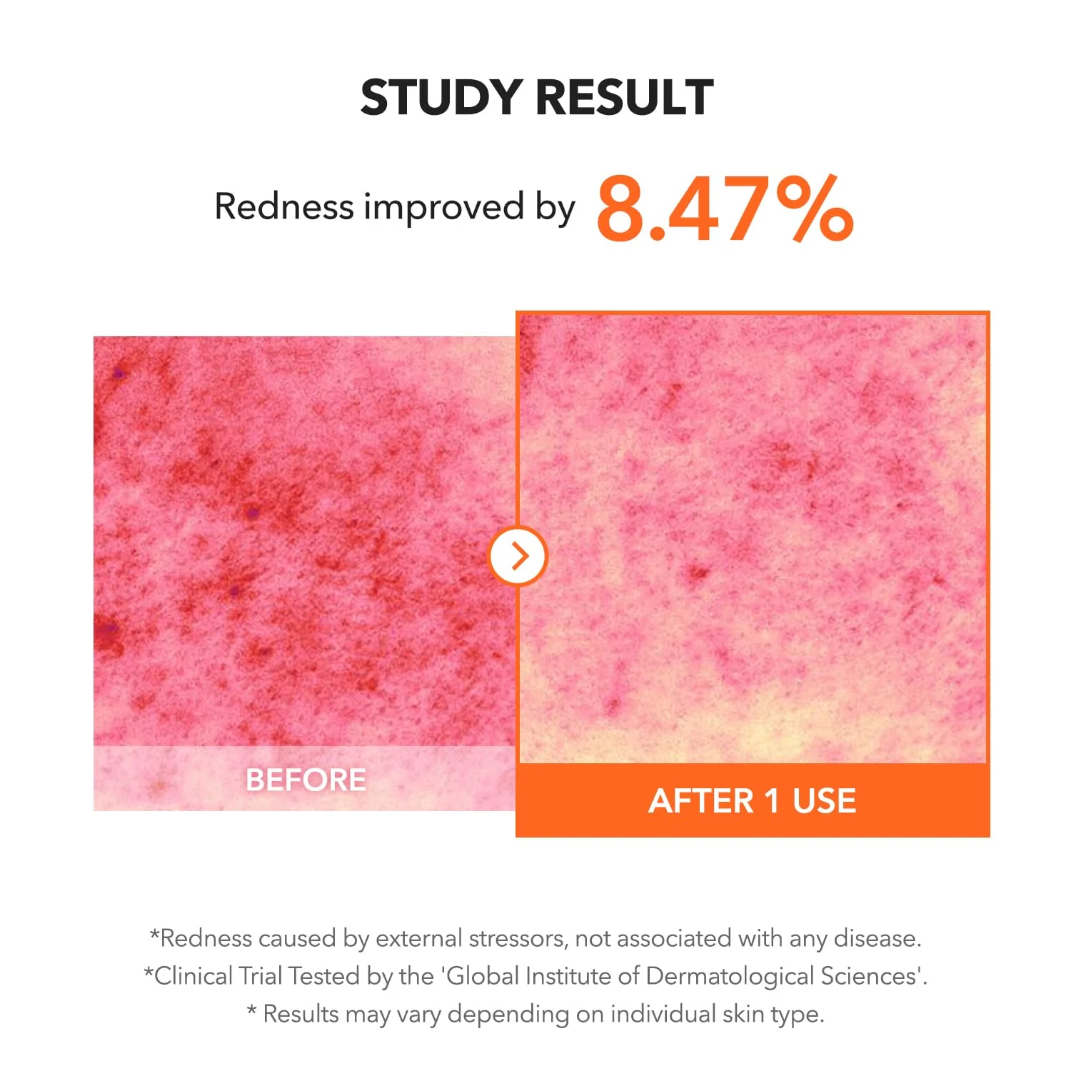 APRILSKIN Carrotene IPMP™ Clearing Solution || Quickly soothes troubled areas and helps clear blemishes | Formulated with BHA, AHA, Niacinamide & Zinc Oxide | Vegan, Cruelty-Free (0.67fl.oz.) - Image 5
