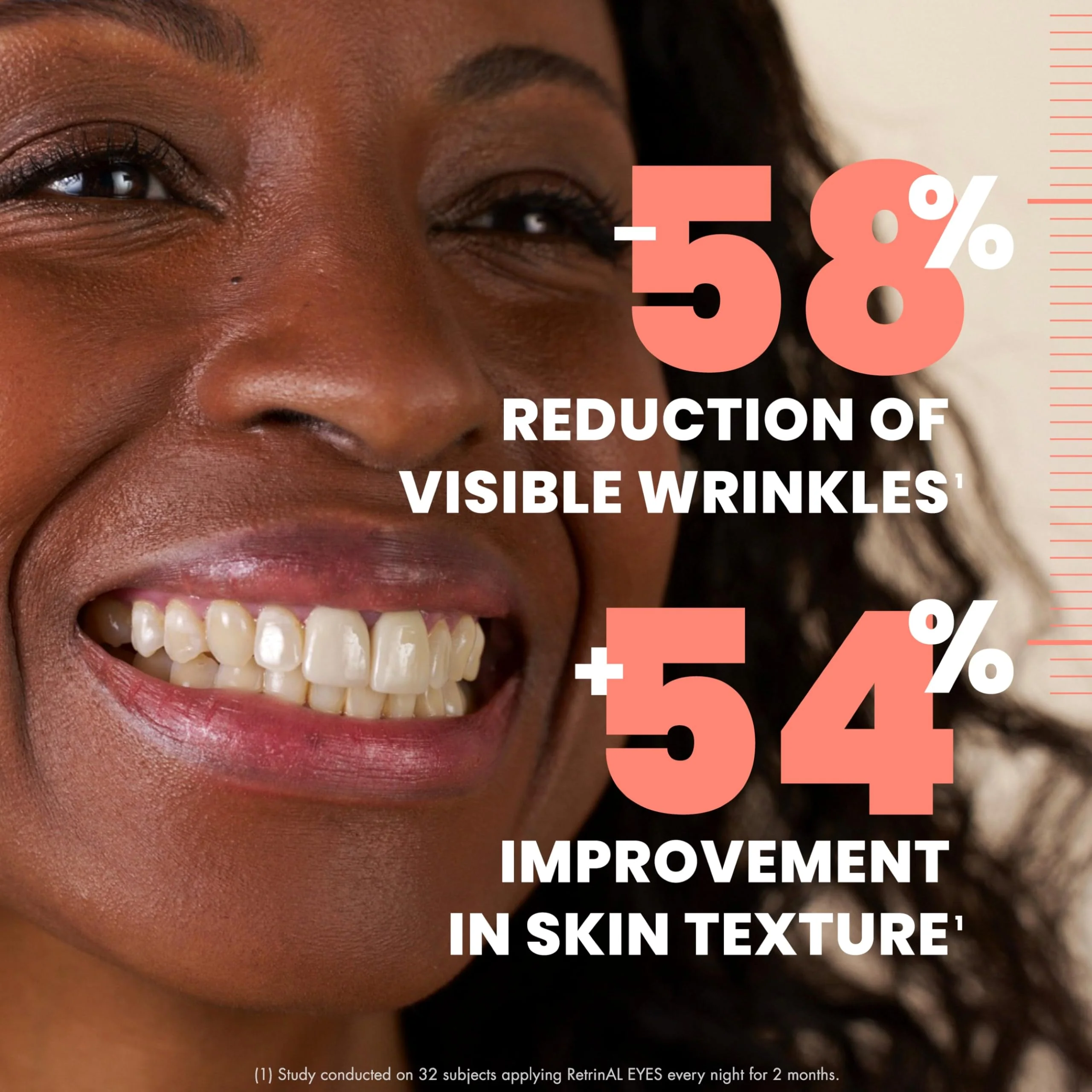 Avene RetrinAL 0.1 Intensive Cream, Retinaldehyde, Reduce Signs of Aging, Brighten & Rejuvenate Skin, 1.01 Oz - Image 6