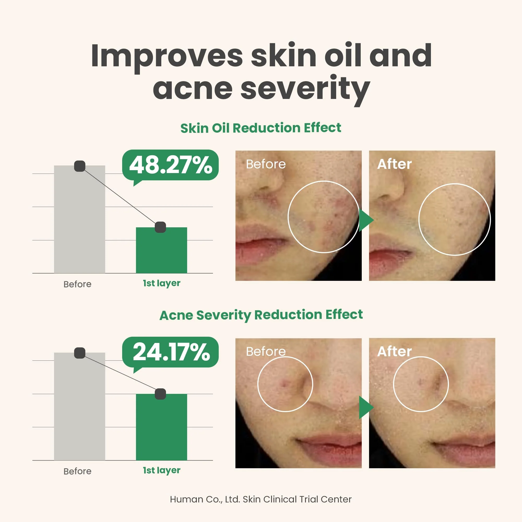 AXIS-Y Spot The Difference Blemish Spot Treatment - 4-Terpineol 2% Niacinamide AHA BHA Soothes Breakouts & Skin Barrier Repair - Vegan Korean Skin Care Face Serum - 0.50 fl. oz. - Image 4