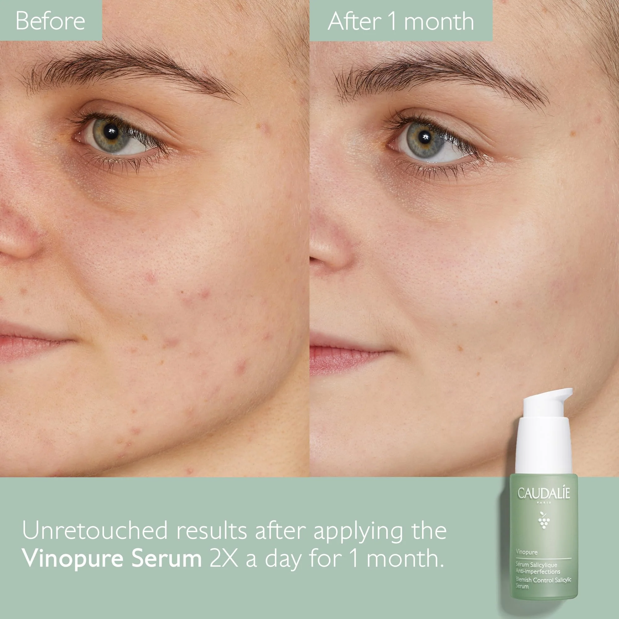 Caudalie Vinopure Natural Salicylic Acid Pore Minimizing Serum with Niacinamide, Skin Perfecting Serum - 30 mL - Image 8