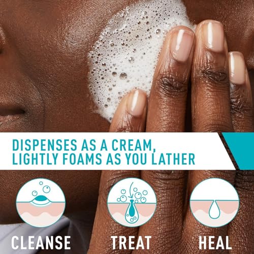 CeraVe Acne Foaming Cream Cleanser, 4% Benzoyl Peroxide Face Wash With Hyaluronic Acid, Niacinamide & Ceramides, Gentle Daily Acne Treatment For Face - Image 7