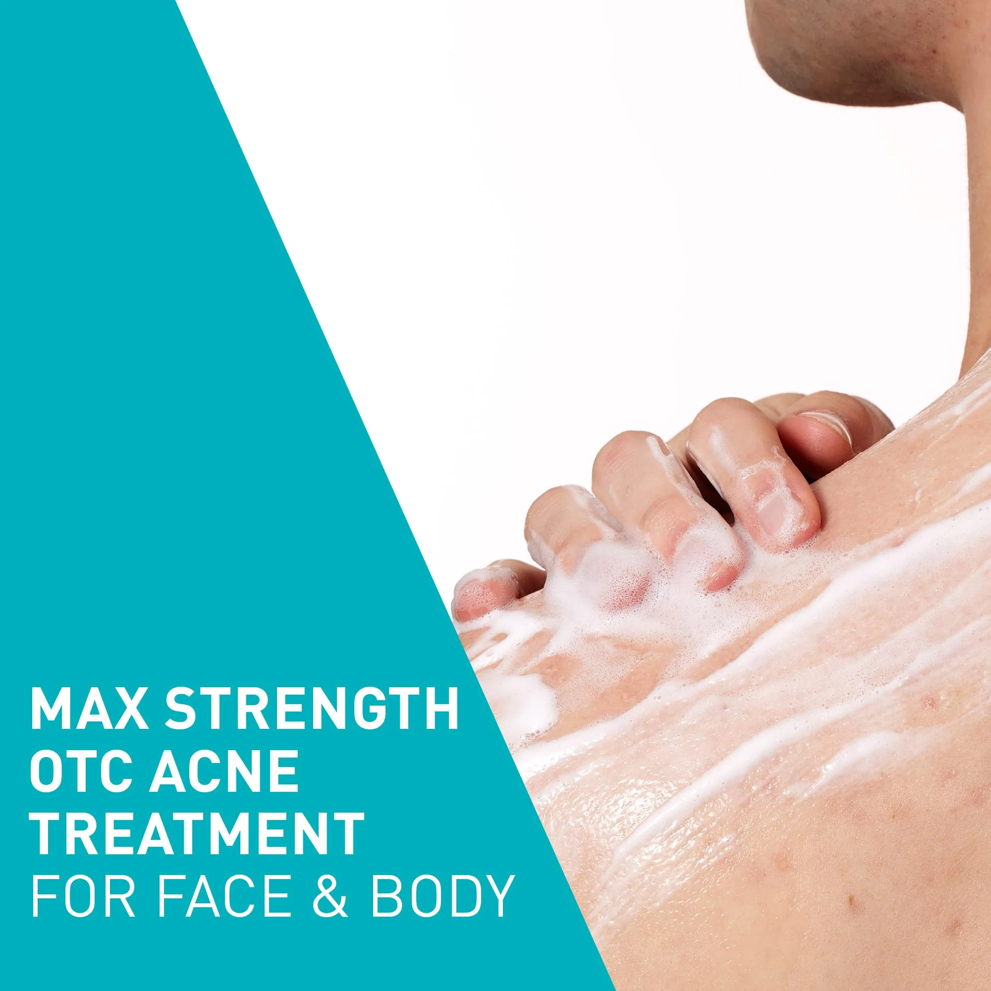 CeraVe Acne Foaming Cream Wash, Gentle Face and Body Cleanser with Benzoyl Peroxide 10%, Hyaluronic Acid, and Niacinamide, 10% Benzoyl Peroxide Treatment Clears Pimples and Blackheads 5 Oz - Image 7