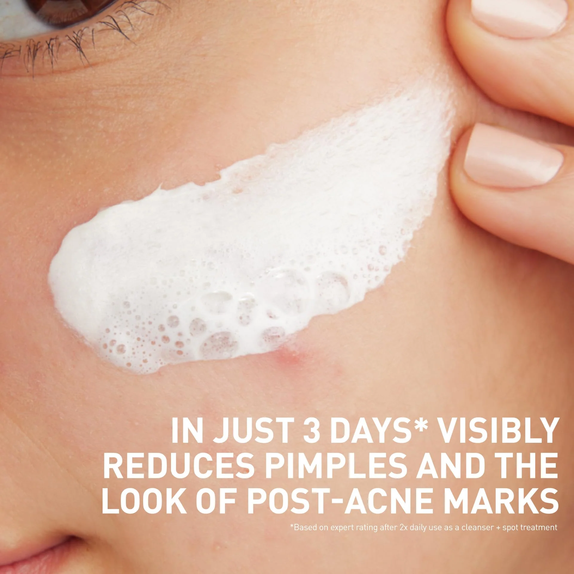 CeraVe Clay To Foam Acne Face Wash, Multi-Use Salicylic Acid & Kaolin Clay Acne Spot Treatment Clears Pimples & Blackheads, Prevents Breakouts, Hydrates & Soothes, Fragrance-Free, Non-Comedogenic, 4oz - Image 6