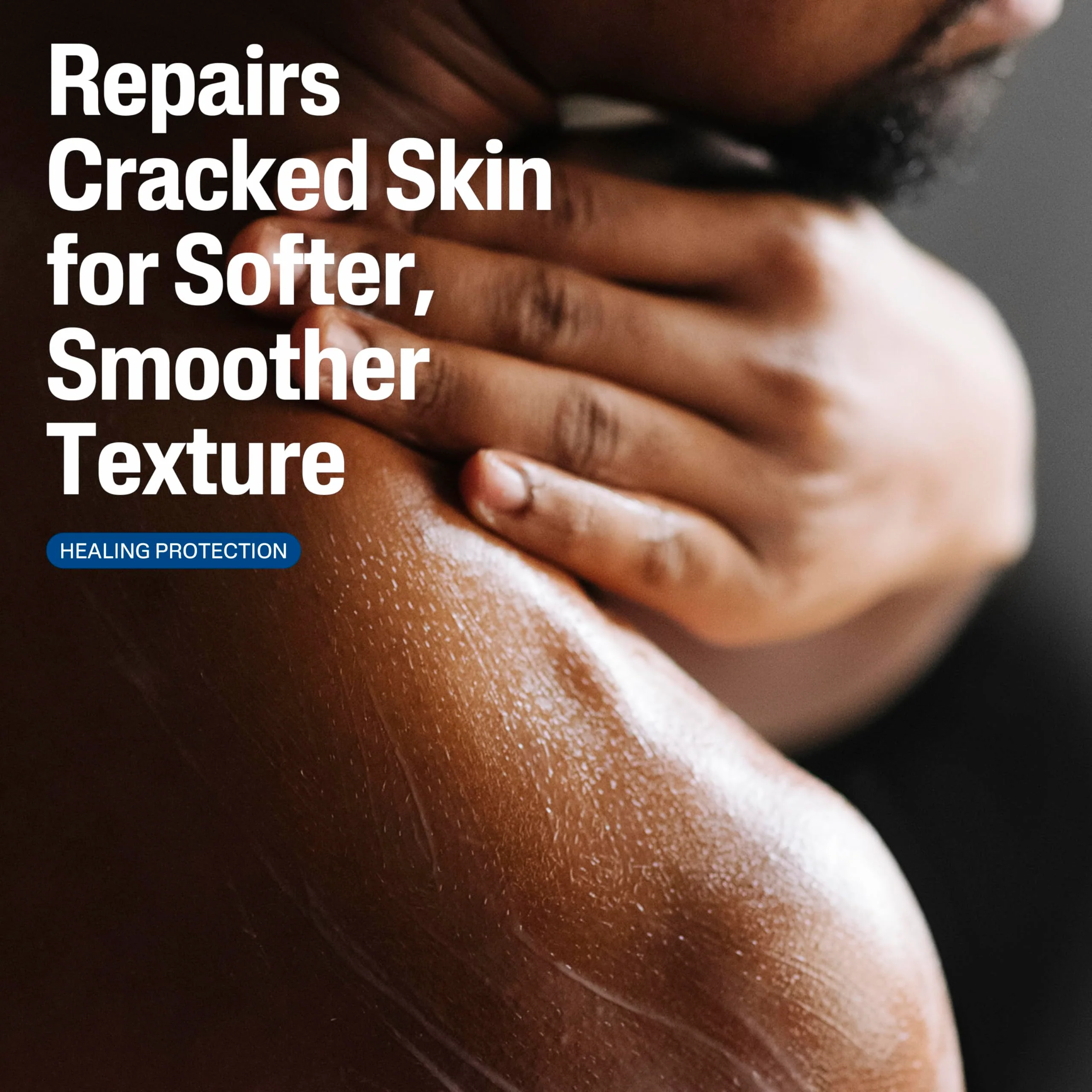 Cetaphil Cracked Skin Repair Lotion, 16 oz, For Very Rough & Cracked, Sensitive Skin, 24 Hour Hydration, Protects & Hydrates Cracked Skin, Hypoallergenic, Fragrance Free - Image 9