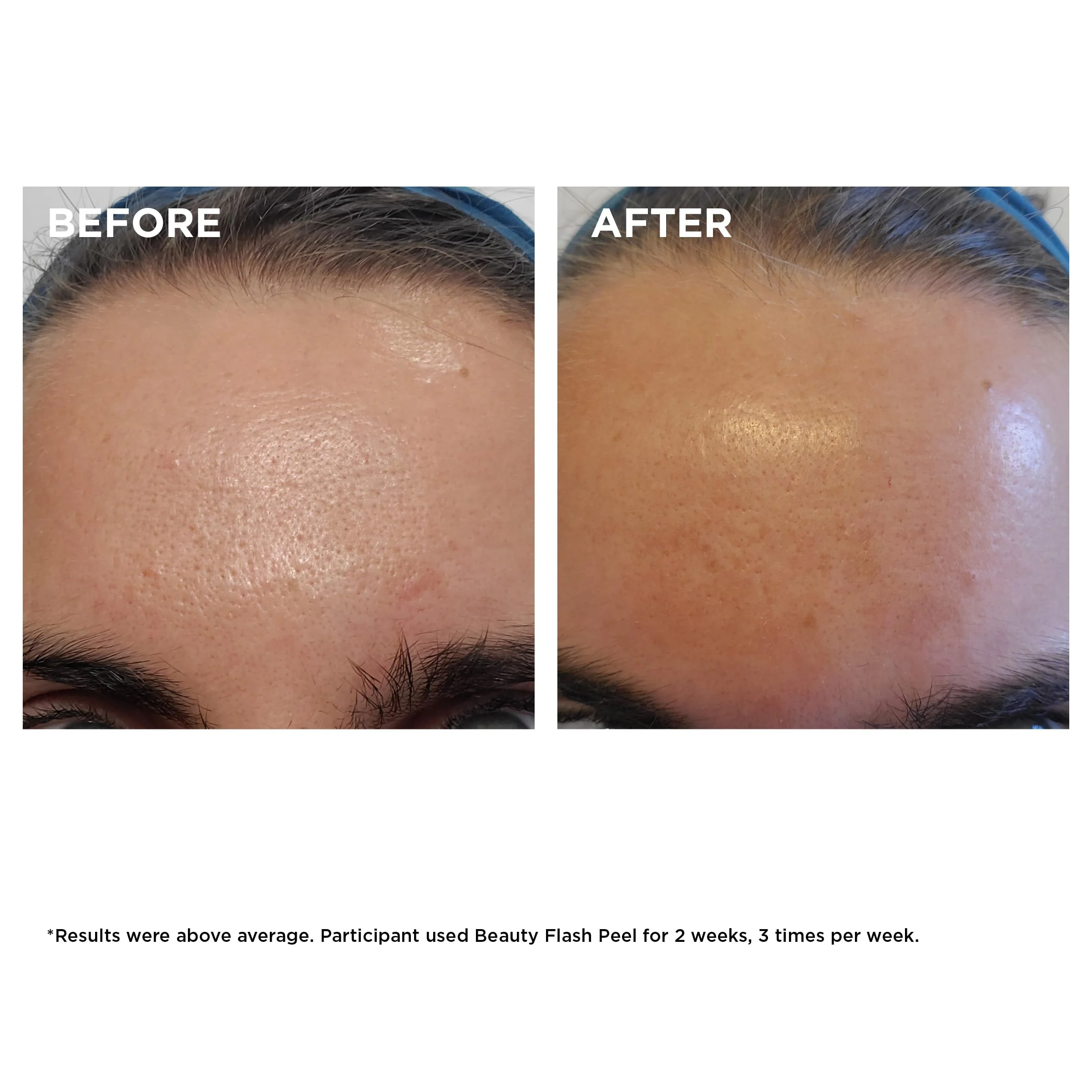 Clarins Beauty Flash Peel | 10-Minute At-Home Facial | Visibly Tightens Pores | Gently Eliminates Dead Skin Cells | Refines Skin Texture | Renews Radiance | Contains AHAs and BHAs | All Skin Types - Image 5