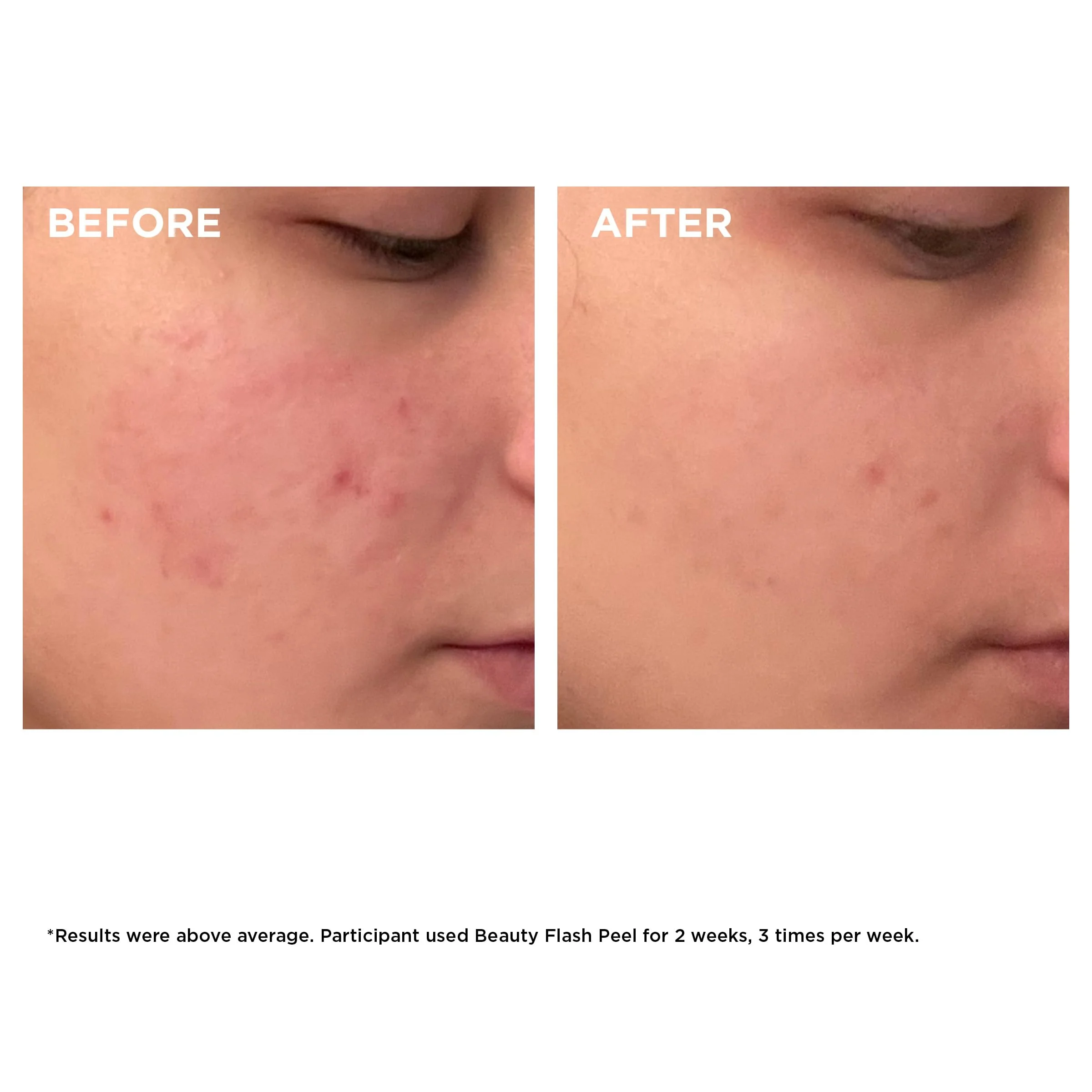 Clarins Beauty Flash Peel | 10-Minute At-Home Facial | Visibly Tightens Pores | Gently Eliminates Dead Skin Cells | Refines Skin Texture | Renews Radiance | Contains AHAs and BHAs | All Skin Types - Image 6