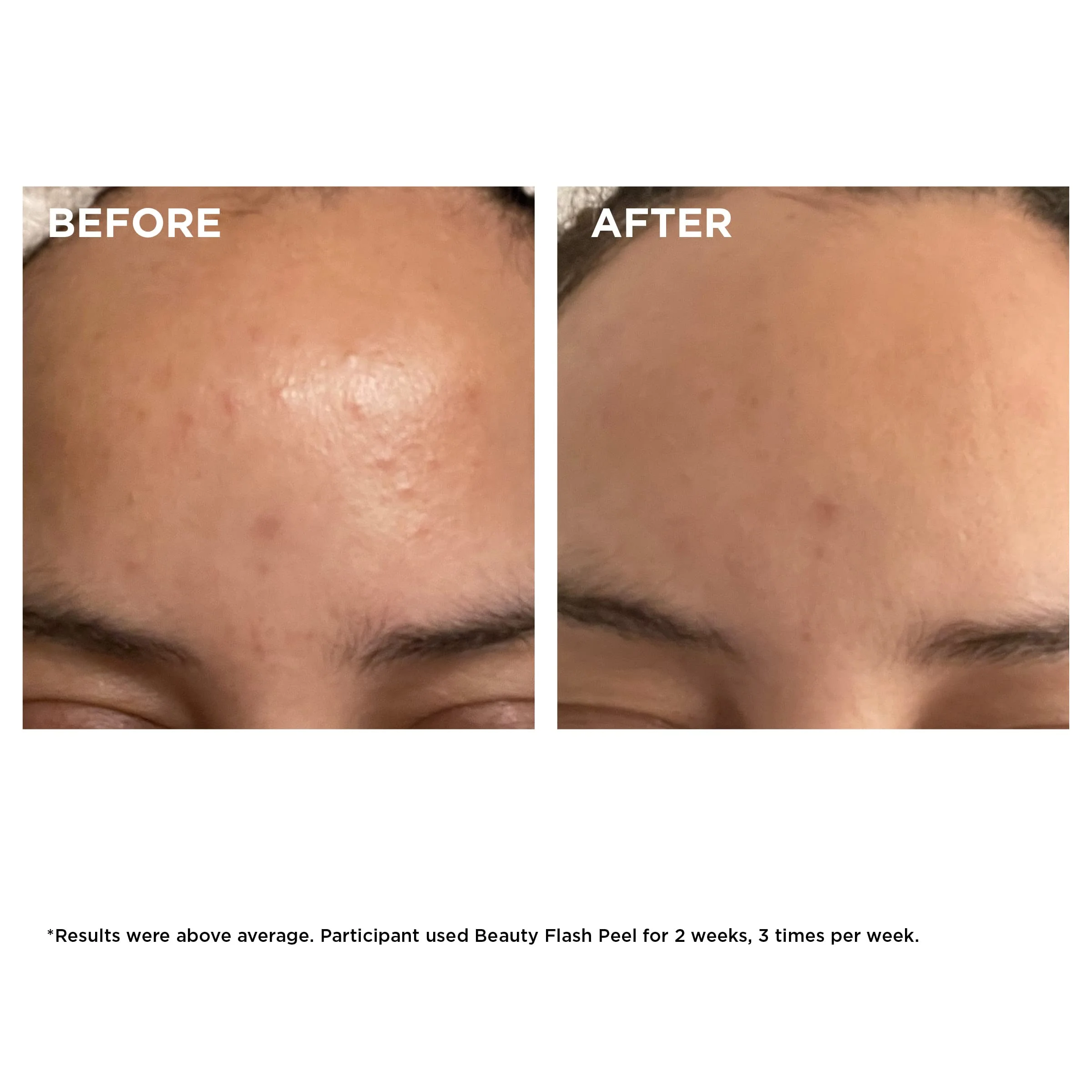 Clarins Beauty Flash Peel | 10-Minute At-Home Facial | Visibly Tightens Pores | Gently Eliminates Dead Skin Cells | Refines Skin Texture | Renews Radiance | Contains AHAs and BHAs | All Skin Types - Image 7