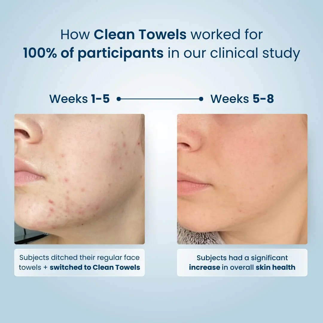 Clean Skin Club Clean Towels®, 100% USDA Biobased Face Towel, Disposable Face Towelette, Eczema Association Accepted, Makeup Remover Dry Wipes, Ultra Soft, 25 ct per pack, 2 Packs, 50 Ct Total - Image 5