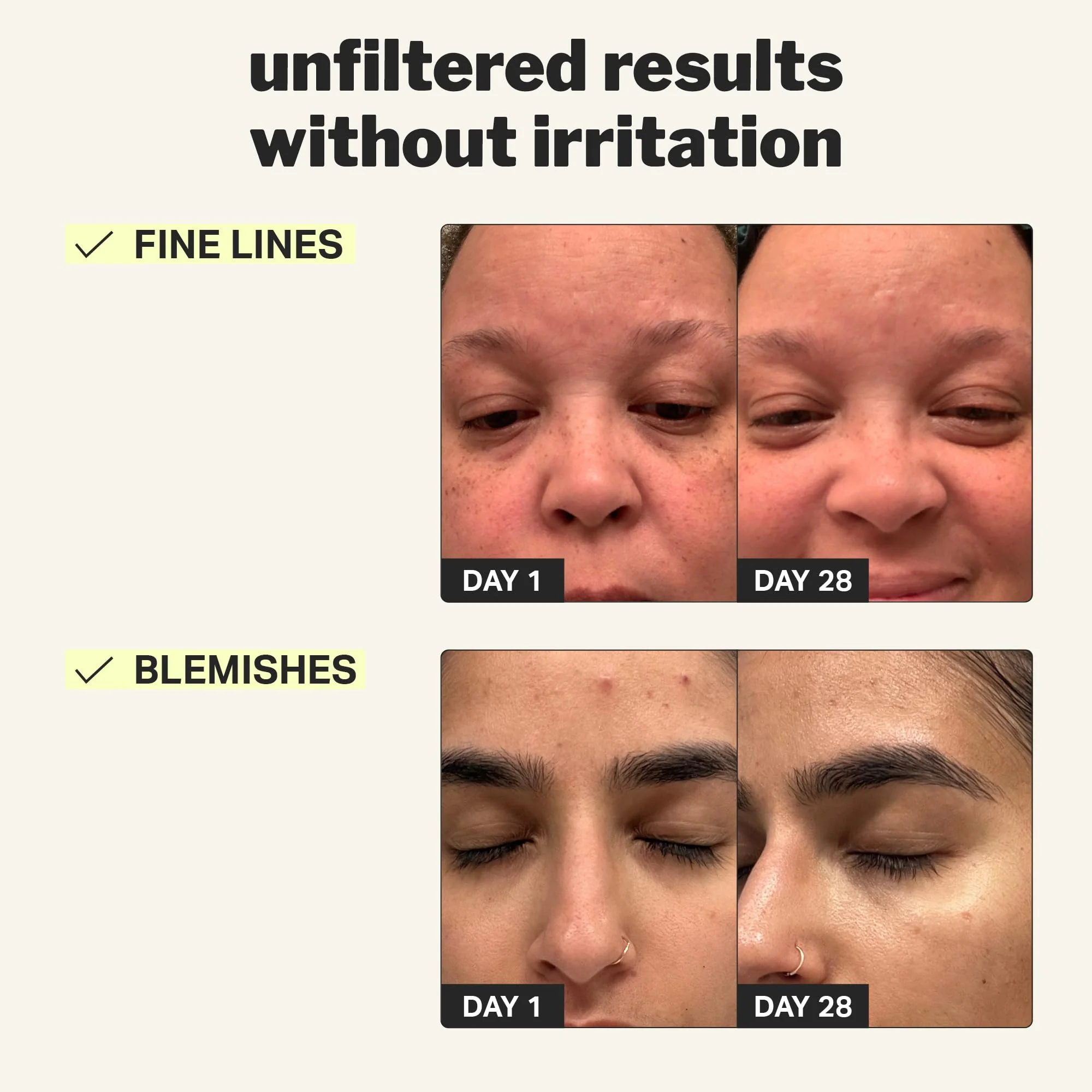 Cocokind Beginner Retinol Gel 0.1%, Improve the Appearance of Fine Lines and Uneven Texture without Irritation, Aloe and Cica to Prevent Dryness, 1 fl oz - Image 5