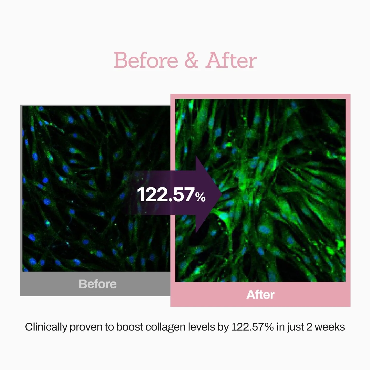 Collagen Peptide 12X Boosting Serum, Enhances Skin Elasticity & Reduces Deep Wrinkles, Promotes Collagen Production for Firm and Youthful Skin, Korean Skincare, 1.01 fl.oz - Image 5