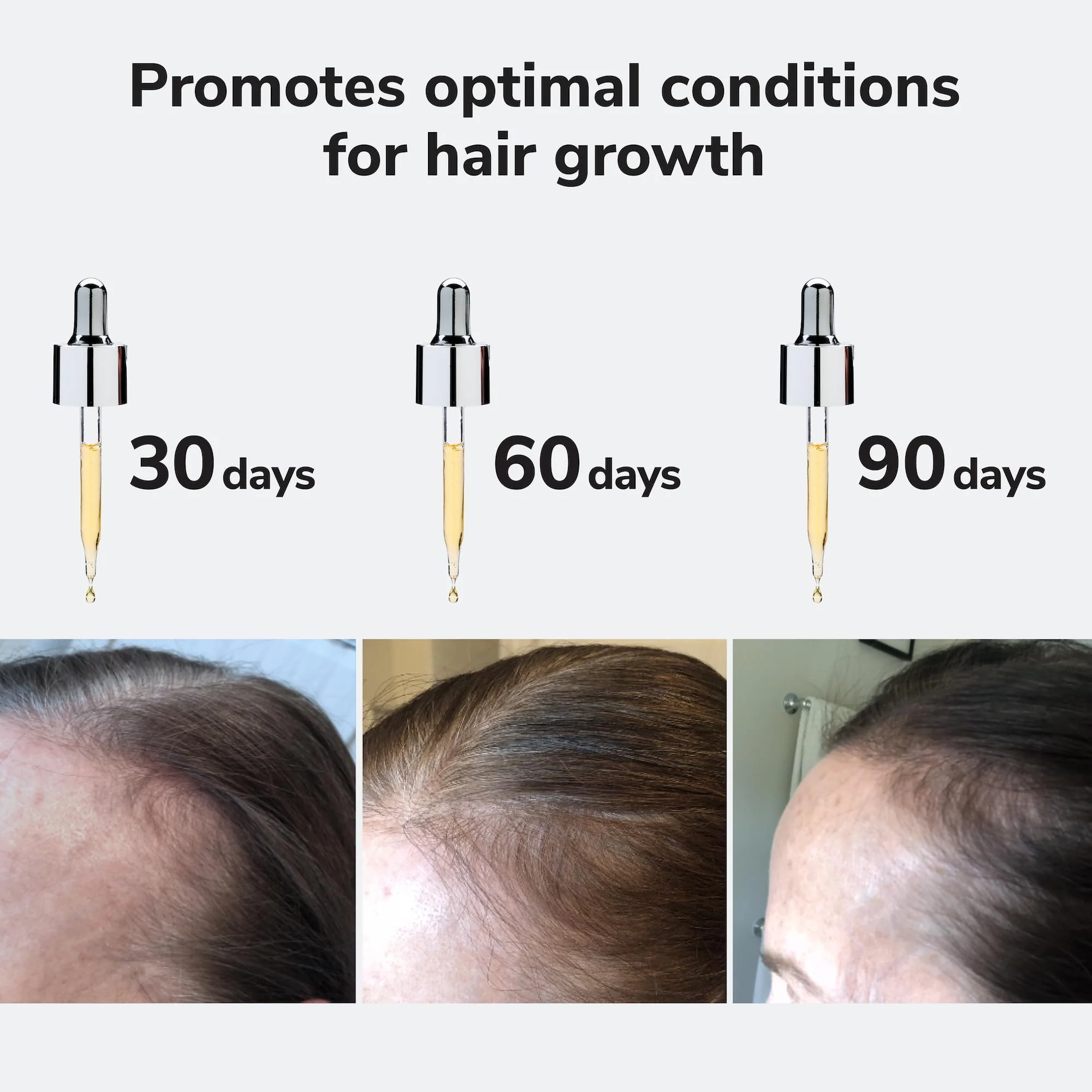 COLOR WOW Youth Juice Collagen Scalp Treatment – Supports scalp collagen to help keep hair follicles strong and elastic | Creates optimal conditions for growth + stronger, thicker, glossy hair - Image 6
