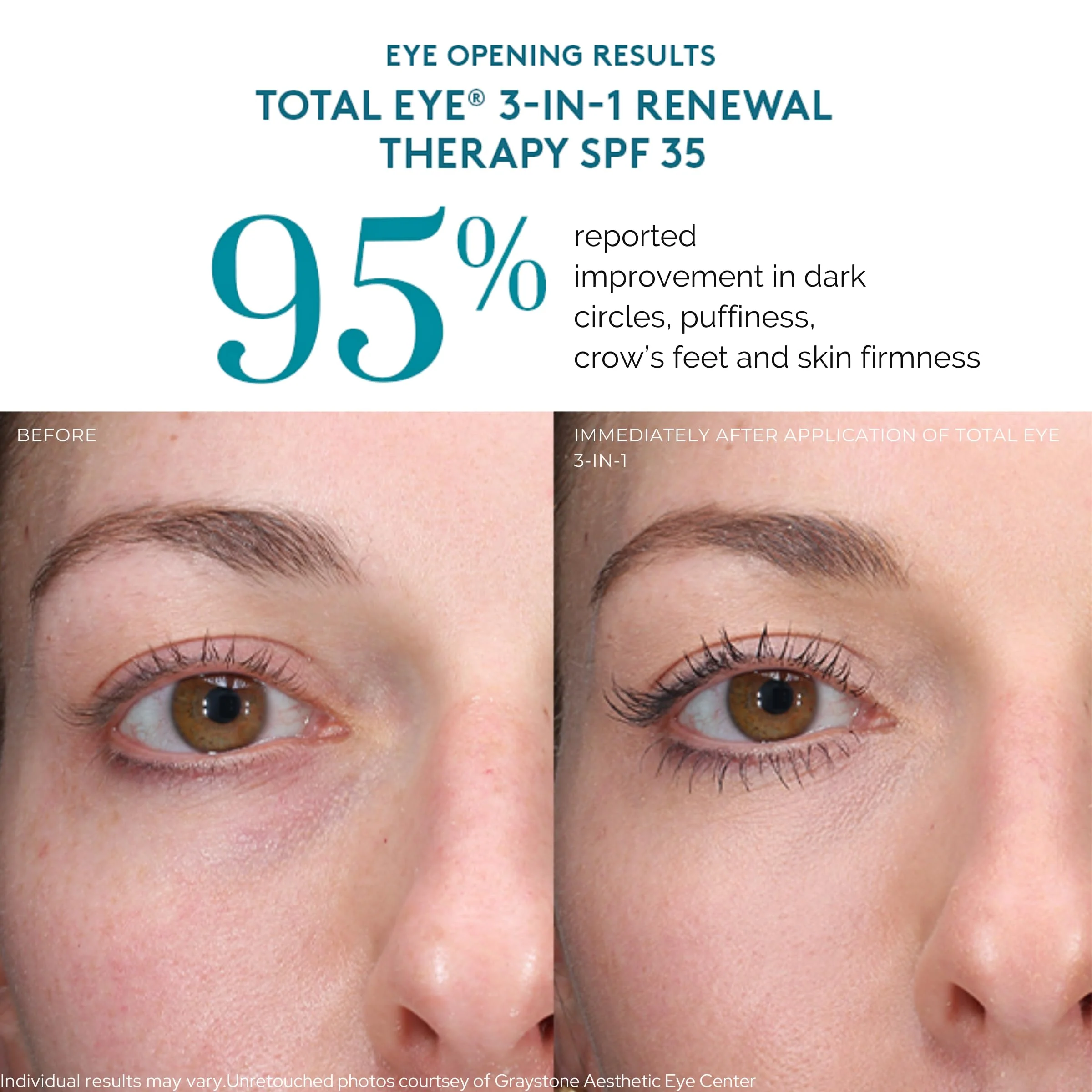 Colorescience Total Eye 3-in-1 Renewal Therapy, 0.23 Fl Oz, Medium - Image 5
