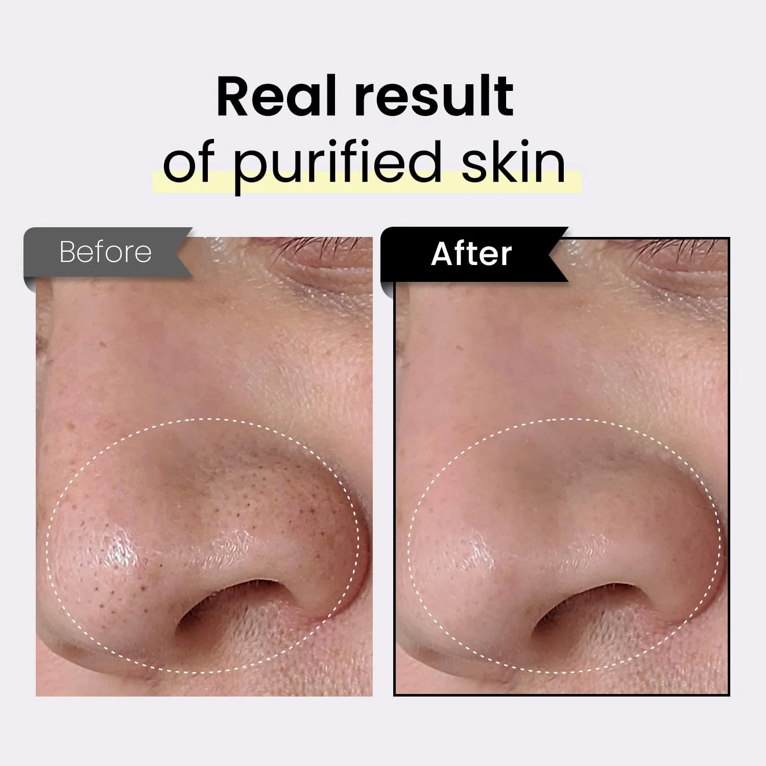 Coxir TXA Black Rice Pore Mask – Korean 3-in-1 Wash-Off Mask Serum| Pore Purifying, Blackhead Care, Hydrating, Skin Toning Treatment with TXA & Black Rice |Vegan K-beuaty Face Mask [50ml/1.69 fl.oz] - Image 7