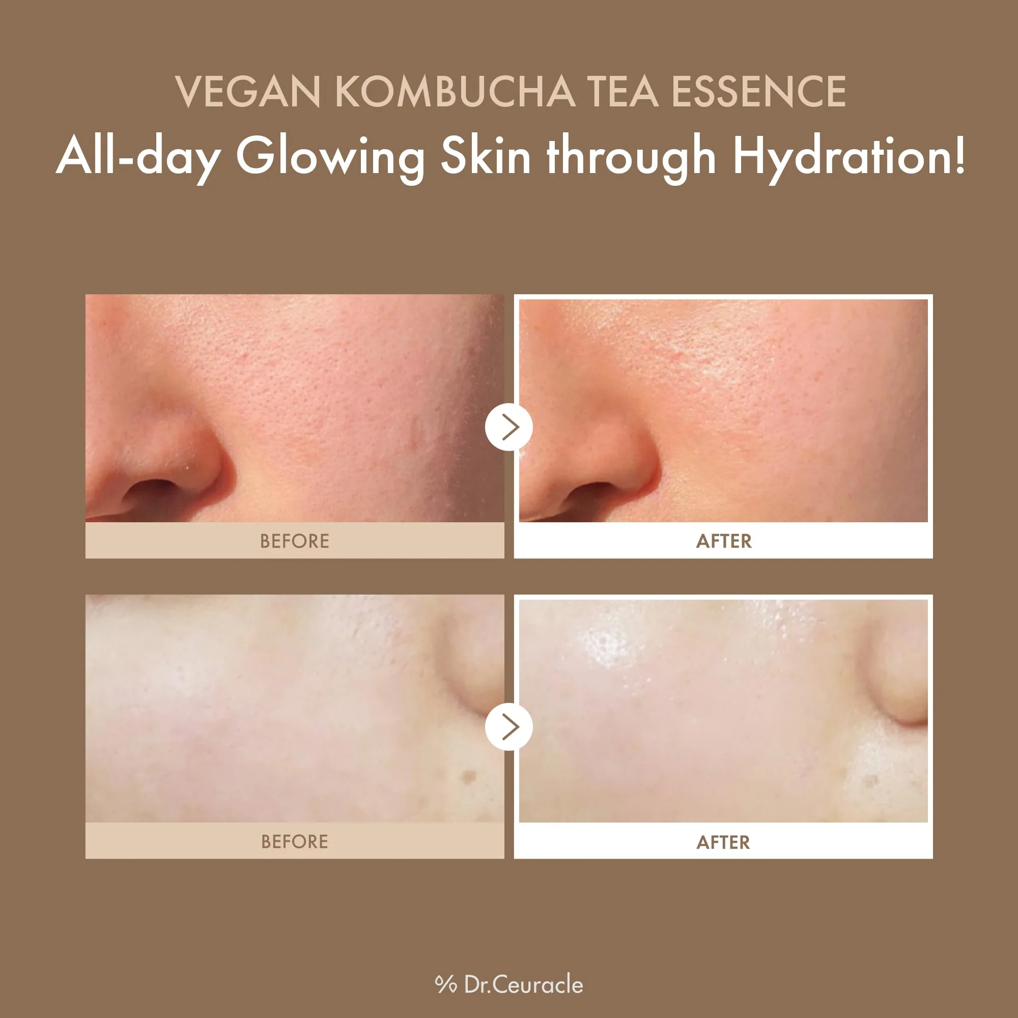 Dr.Ceuracle Vegan Kombucha Tea Essence - Hydrating Milky Toner with Kombucha Tea Extract, Centella Asiatica, Ceramide, Korean Skincare Essence (150 ml / 5.07 fl. oz.) - Image 9