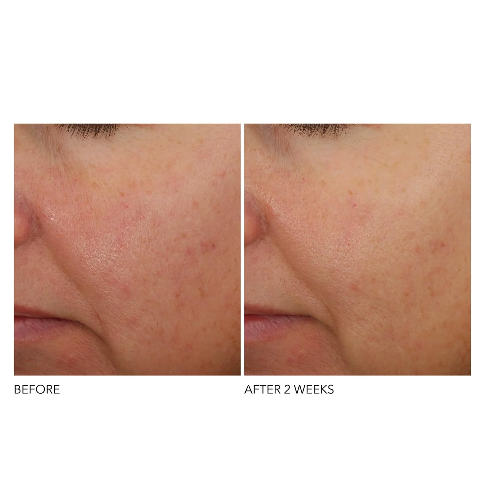 Dr Dennis Gross Advanced Retinol and Ferulic Overnight Wrinkle Treatment, White, 1 oz/ 30 mL - Image 5