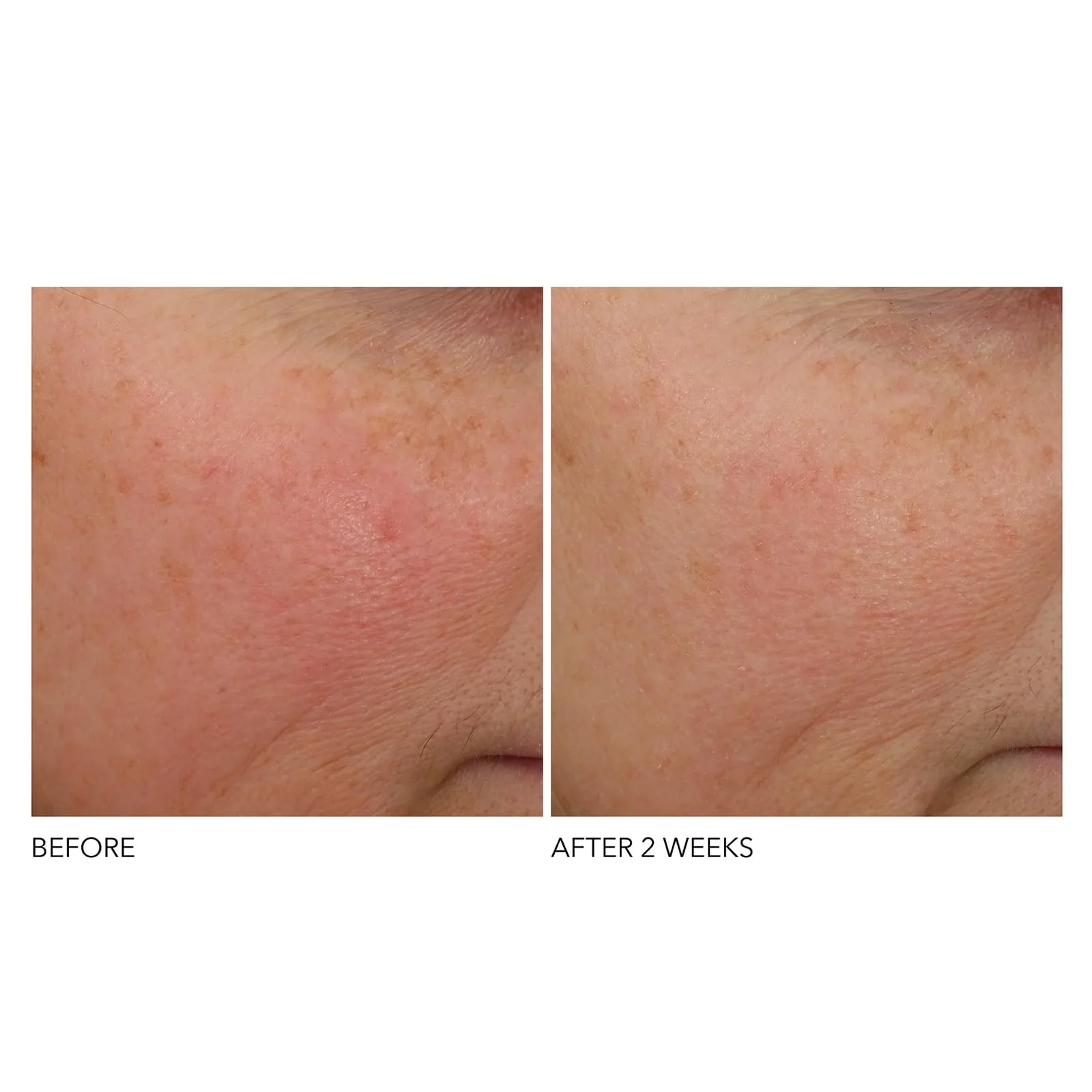 Dr Dennis Gross Advanced Retinol and Ferulic Overnight Wrinkle Treatment, White, 1 oz/ 30 mL - Image 6