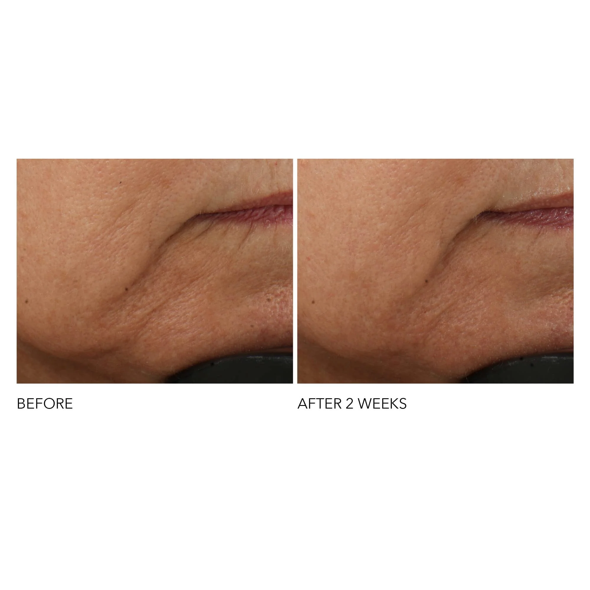 Dr Dennis Gross Advanced Retinol + Ferulic Intense Wrinkle Cream | Intensely Hydrating to Visibly Transform Skin and Repair the Moisture Barrier | 2 oz - Image 4
