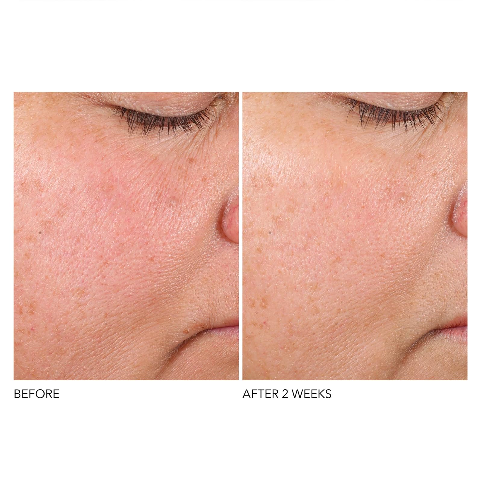 Dr. Dennis Gross Advanced Retinol + Ferulic Texture Renewal Serum – Anti-Aging Formula to Smooth Texture, Boost Radiance, and Minimize Fine Lines & Wrinkles, 1 oz - Image 5