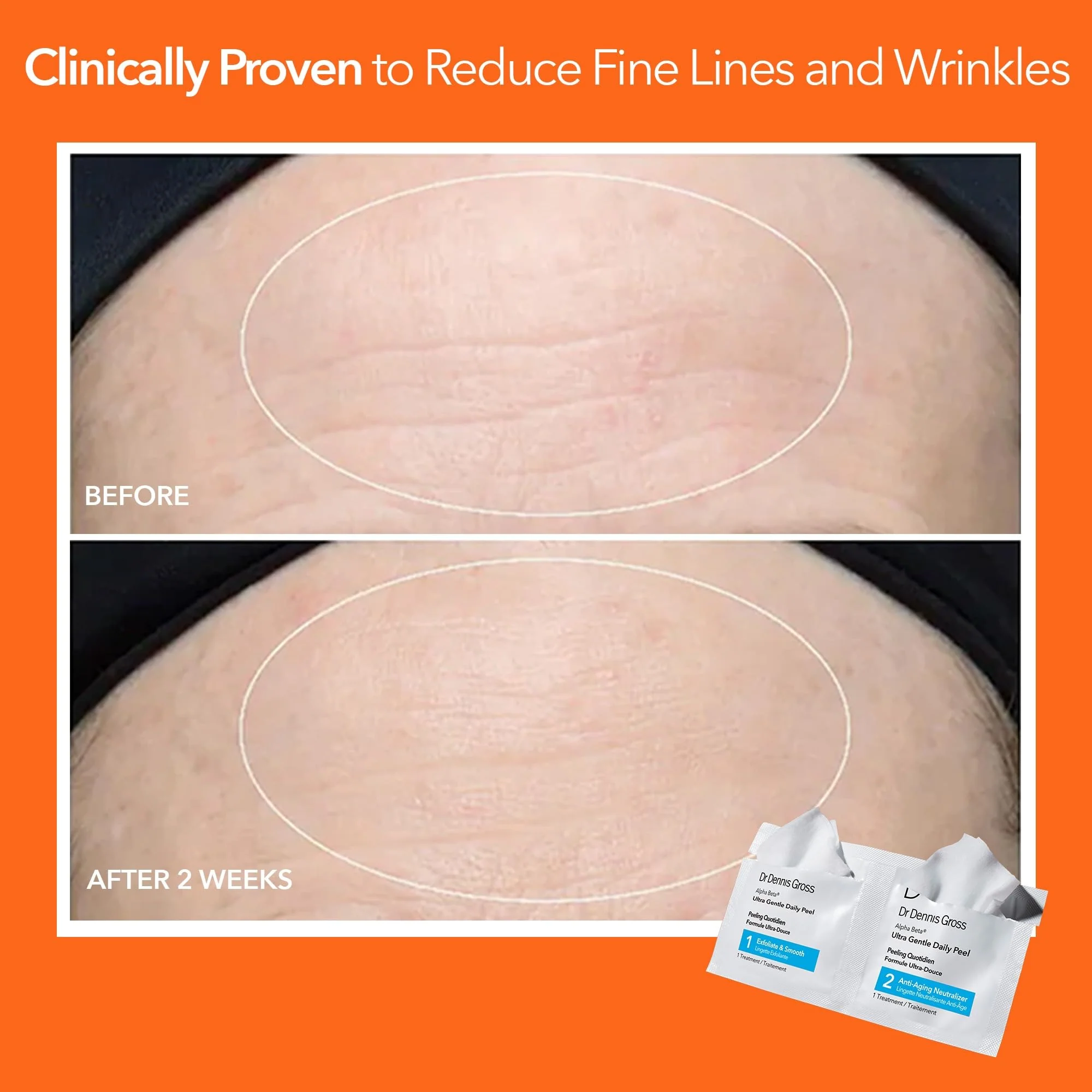Dr. Dennis Gross Alpha Beta Ultra Gentle Daily Peel: for Dehydrated or Sensitive Skin, Uneven Tone or Texture, Fine Lines or Enlarged Pores (5 Treatments) - Image 7