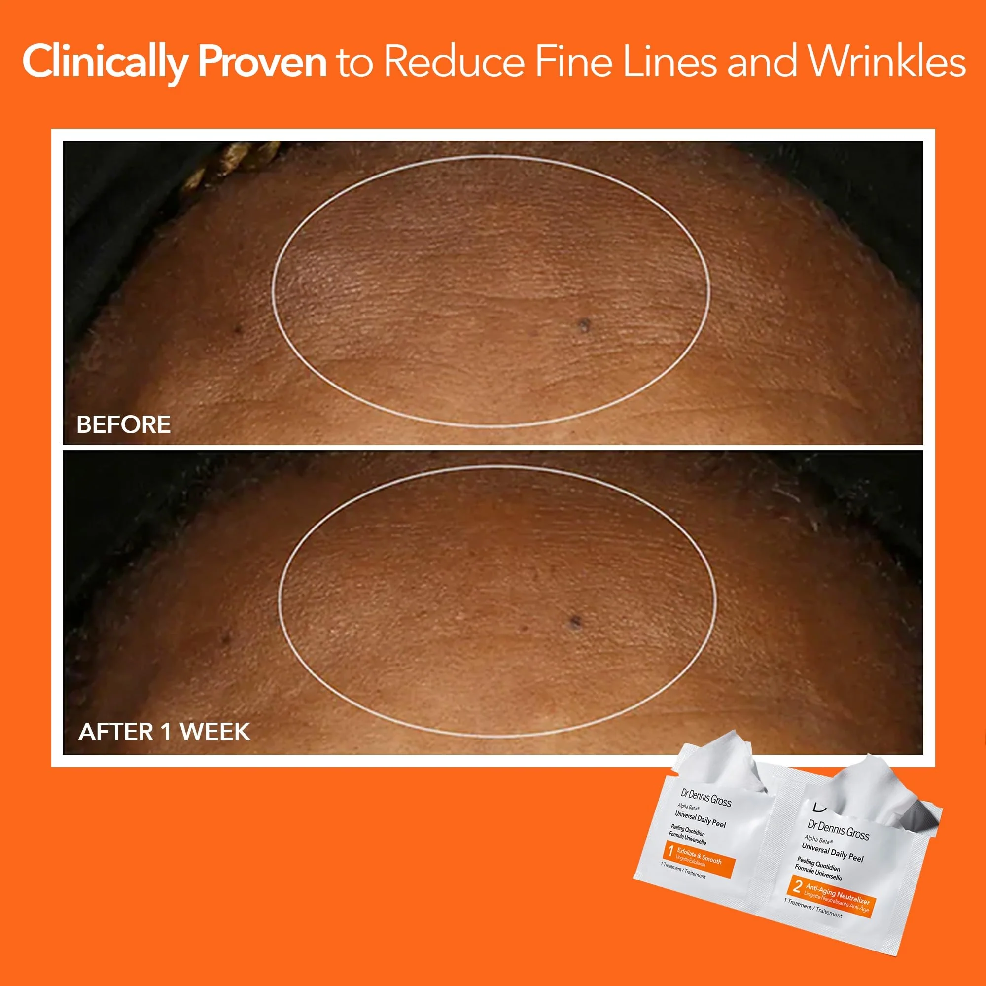 Dr Dennis Gross Alpha Beta Universal Daily Peel: for Uneven Tone or Texture and Fine Lines or Enlarged Pores, (5 Treatments) - Image 7