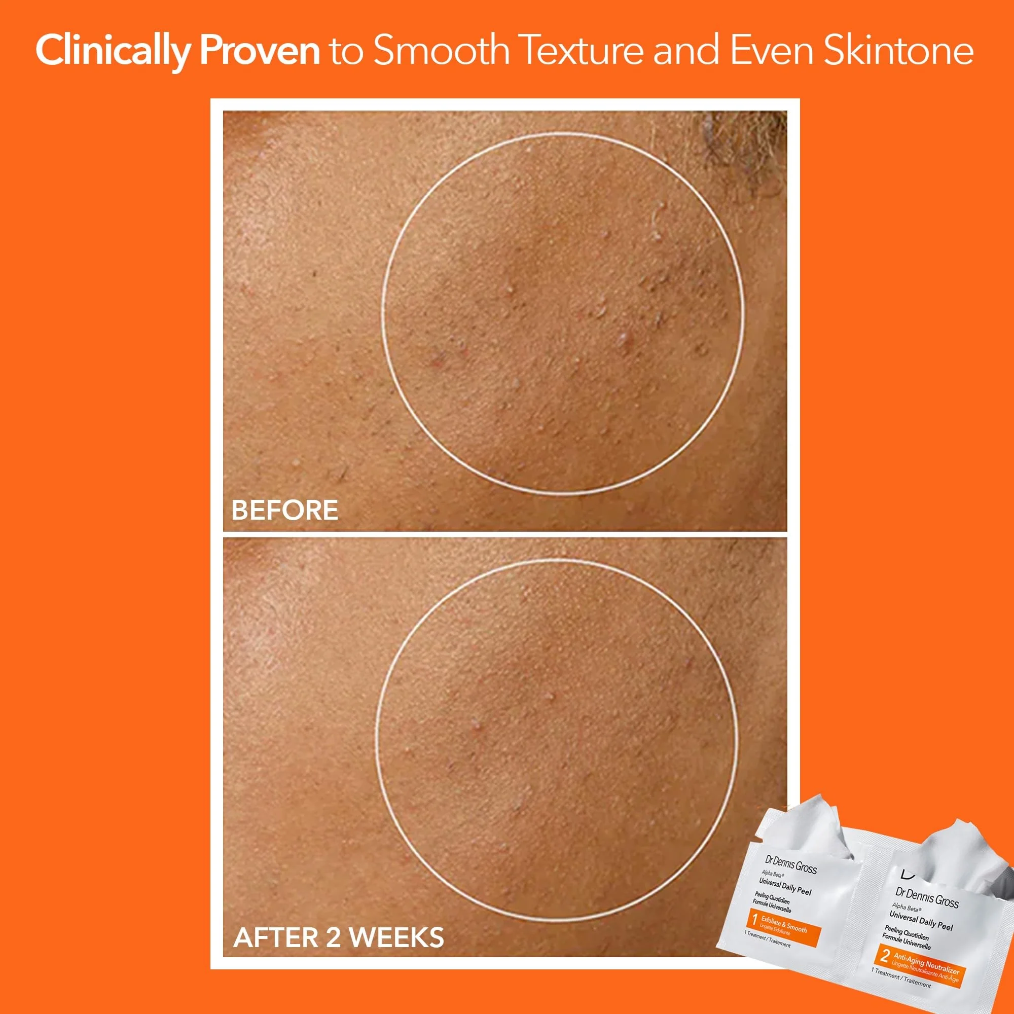 Dr Dennis Gross Alpha Beta Universal Daily Peel: for Uneven Tone or Texture and Fine Lines or Enlarged Pores, (5 Treatments) - Image 9