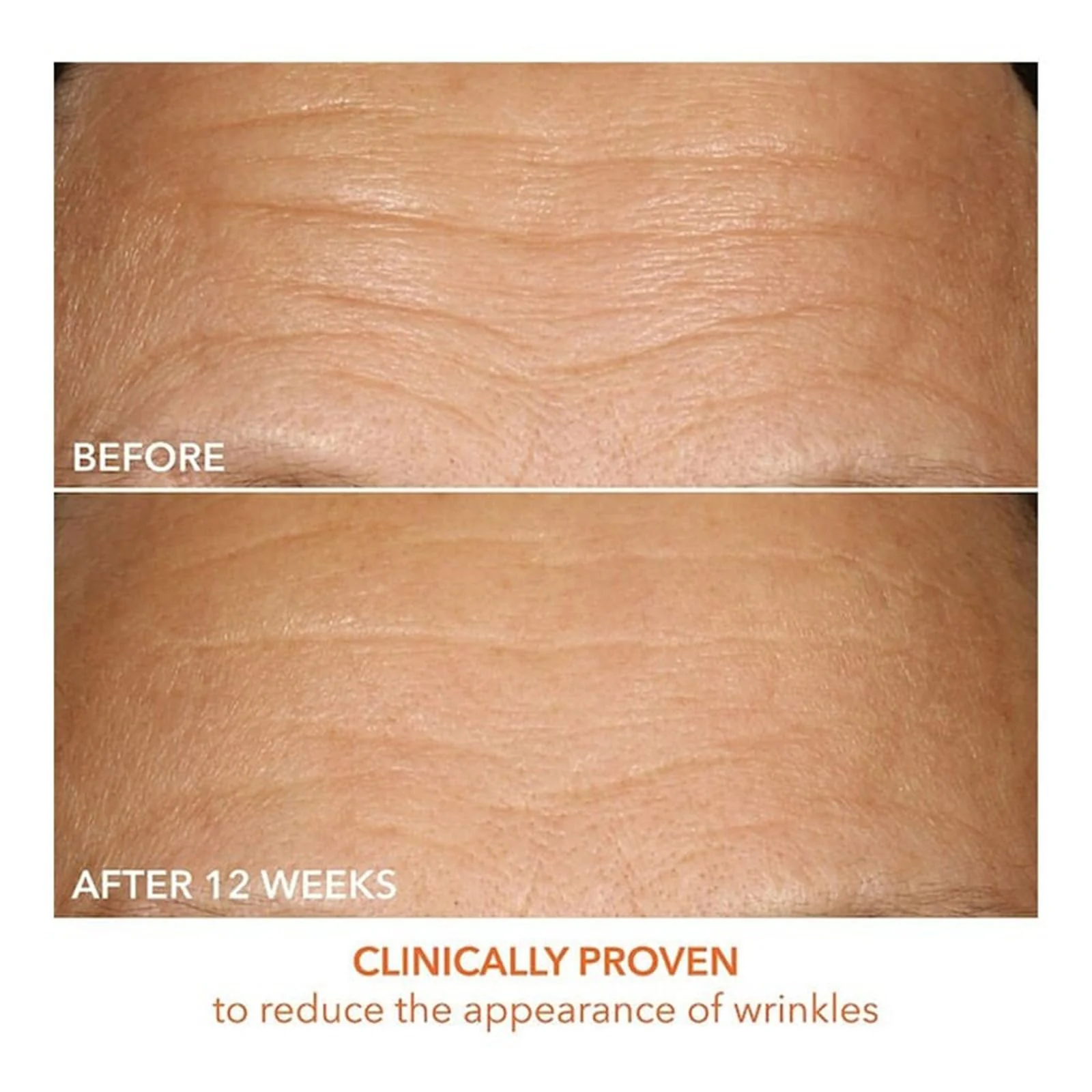 Dr Dennis Gross Vitamin C Lactic 15% Firm & Brighten Serum - Image 3
