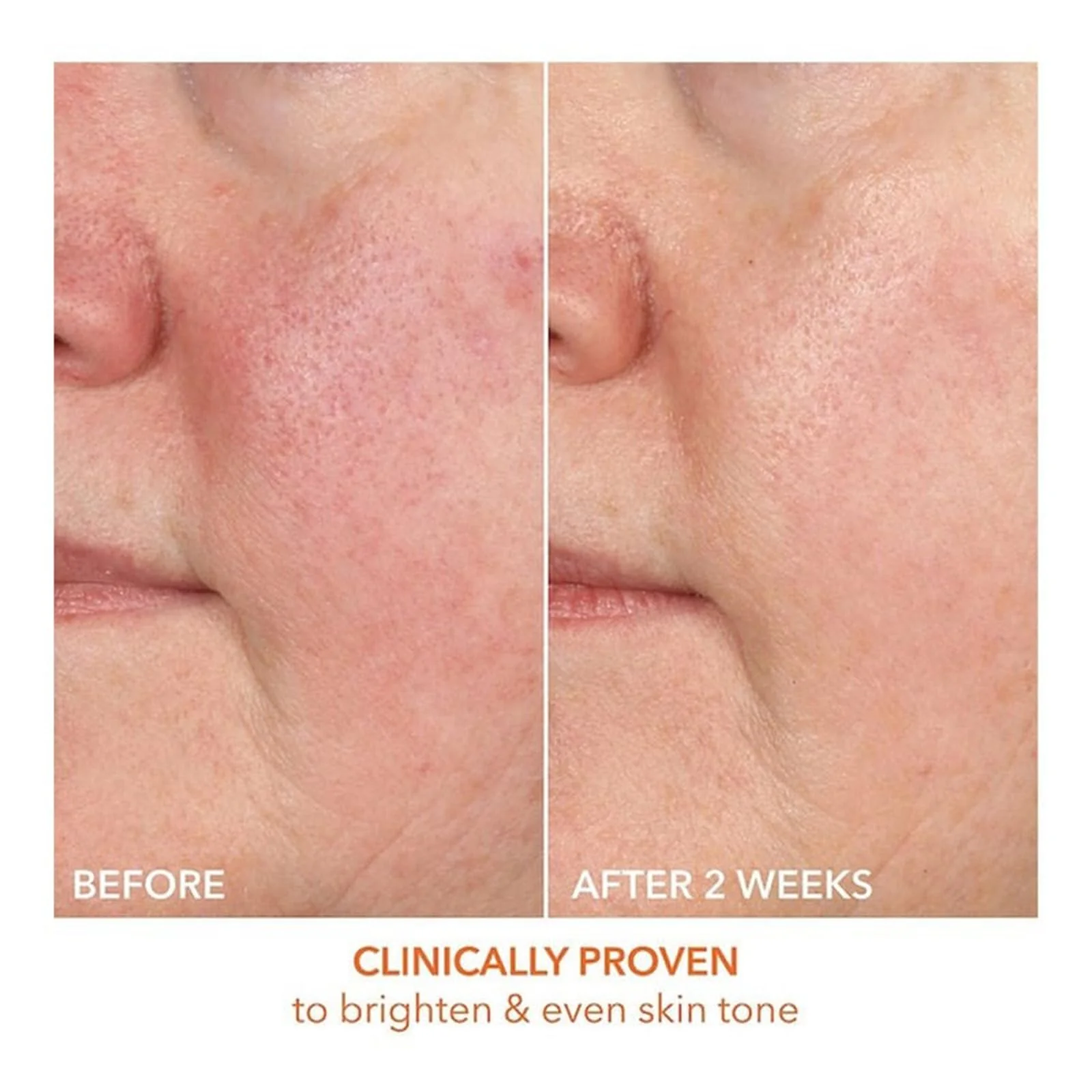 Dr Dennis Gross Vitamin C Lactic 15% Firm & Brighten Serum - Image 4
