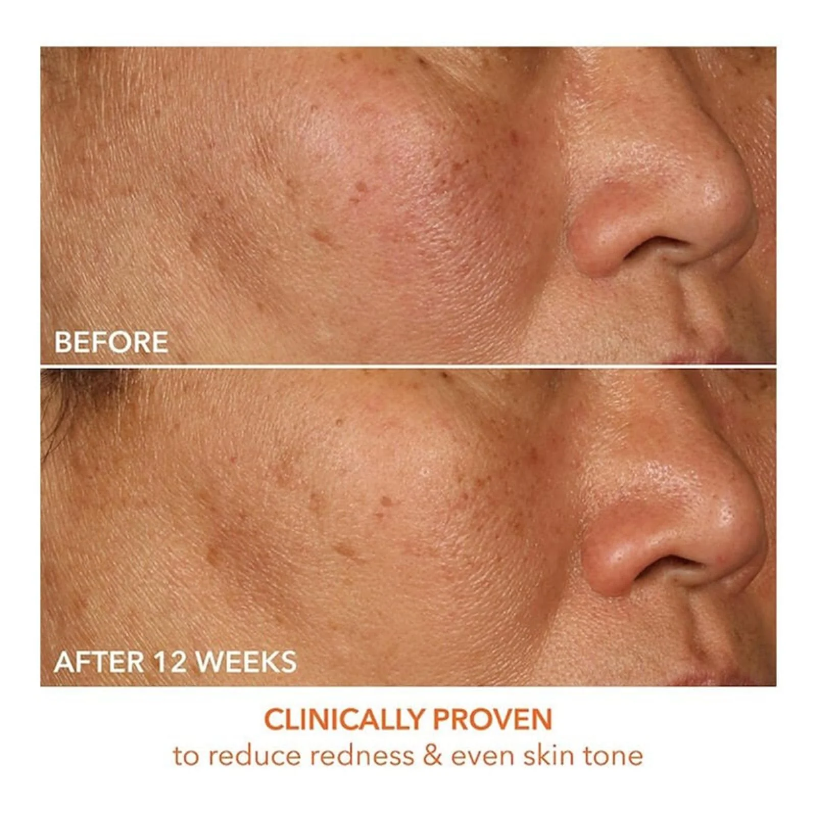Dr Dennis Gross Vitamin C Lactic 15% Firm & Brighten Serum - Image 5