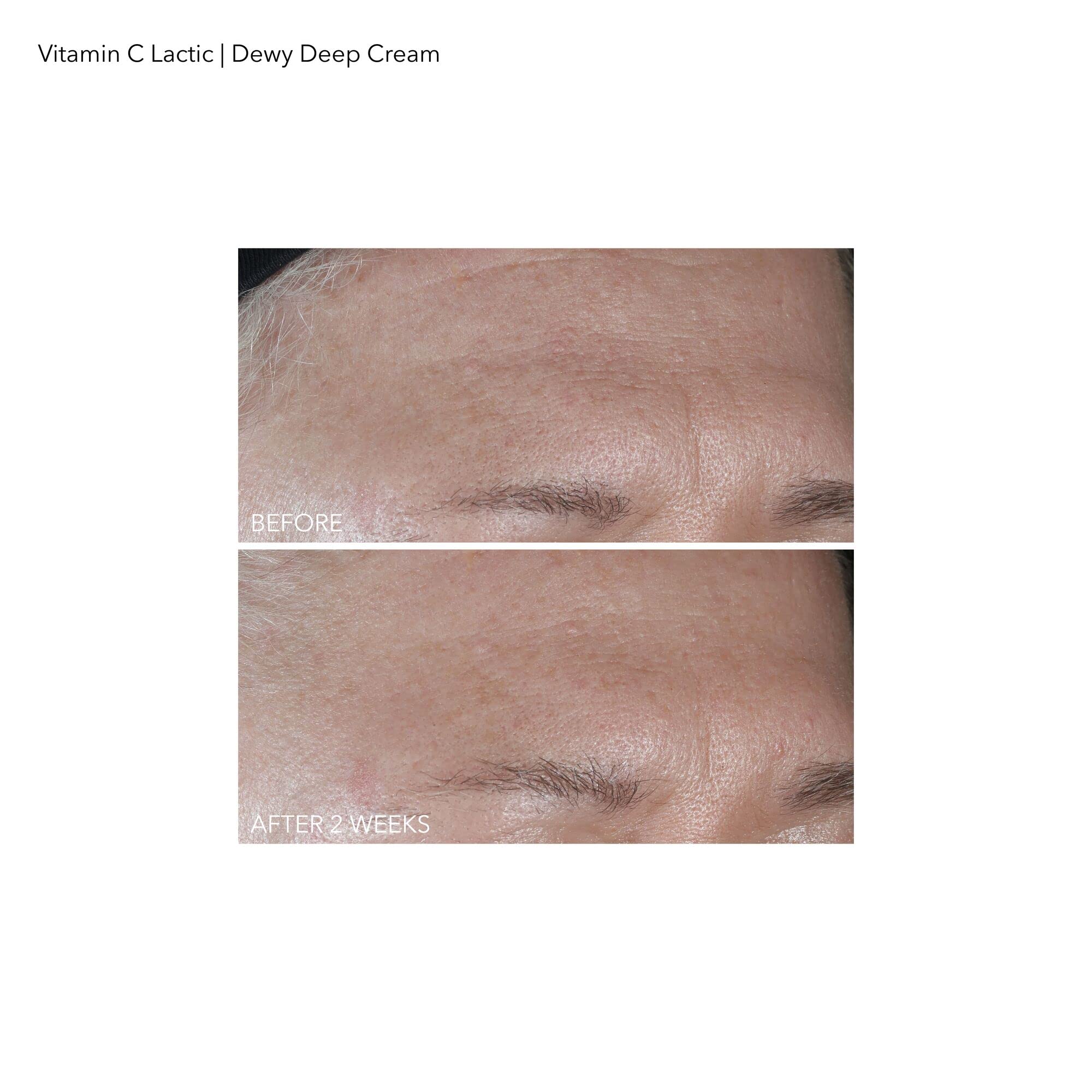Dr Dennis Gross Vitamin C Plus Lactic Dewy Deep Cream Cream Unisex 2 oz - Image 3