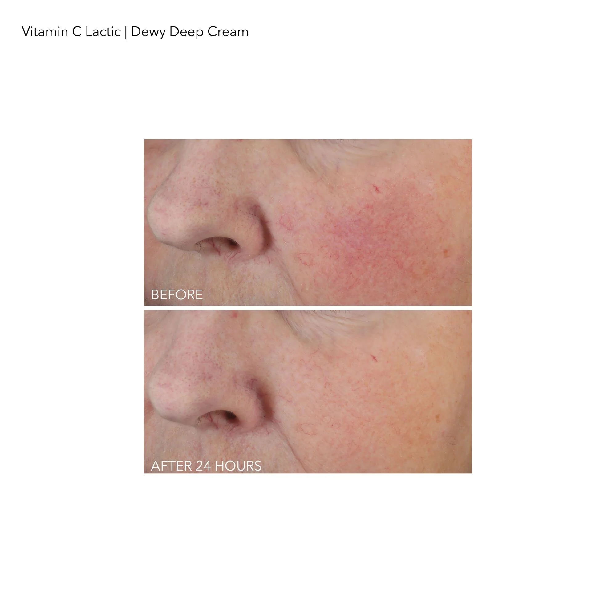 Dr Dennis Gross Vitamin C Plus Lactic Dewy Deep Cream Cream Unisex 2 oz - Image 4