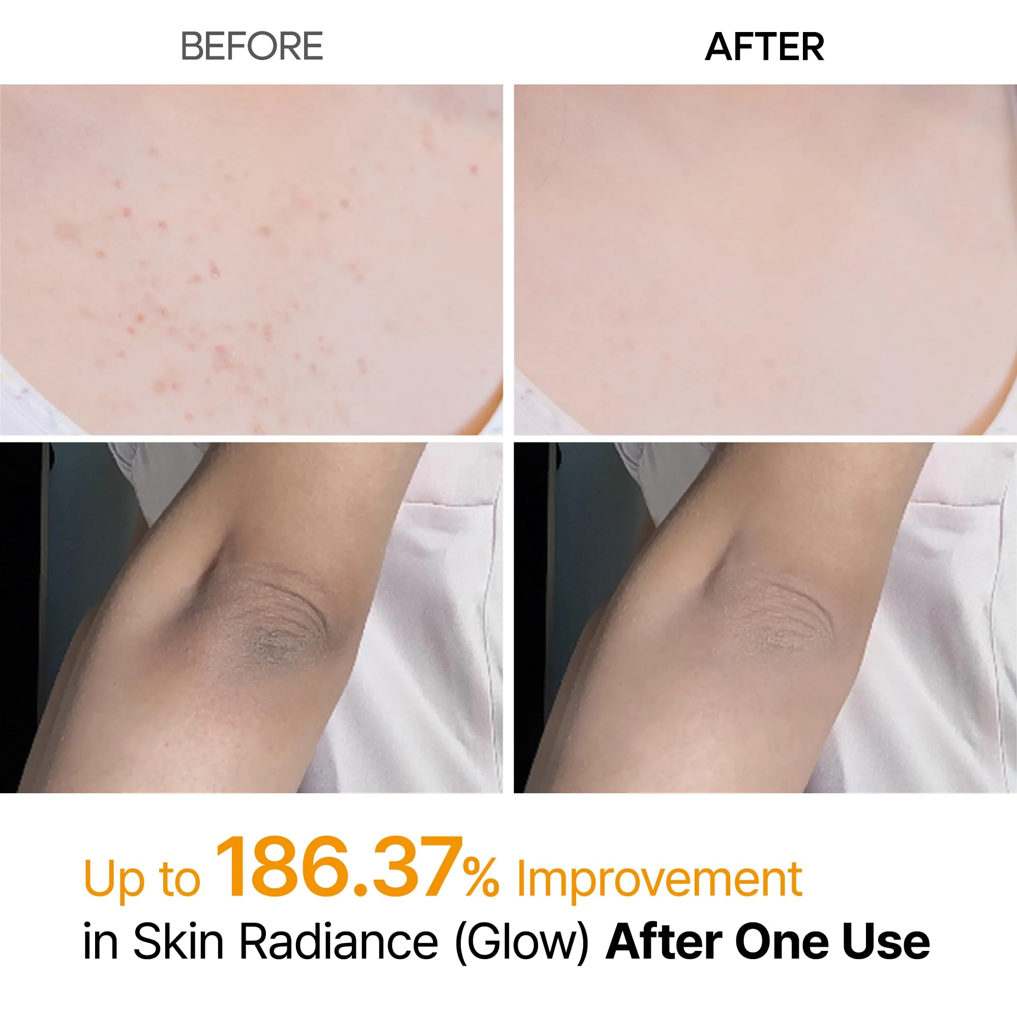 Dr.Melaxin Body Keratin Care Kojic Acid Turmeric Spray Gently Exfoliating Peeling Solution Korean Skincare All Skin Types 200ml - Image 8