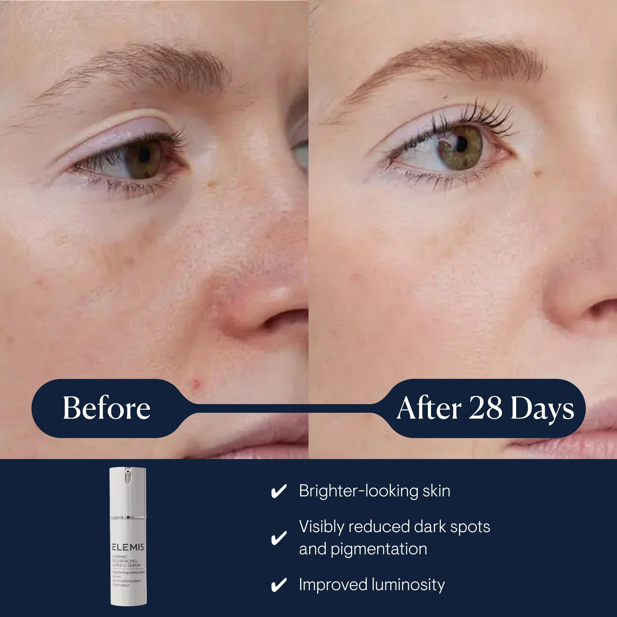 ELEMIS Dynamic Resurfacing Super-C Serum, Daily Anti-Aging Antioxidant Serum Brightens, Refines, and Illuminates Dull Skin with Vitamin C, 30 mL - Image 9