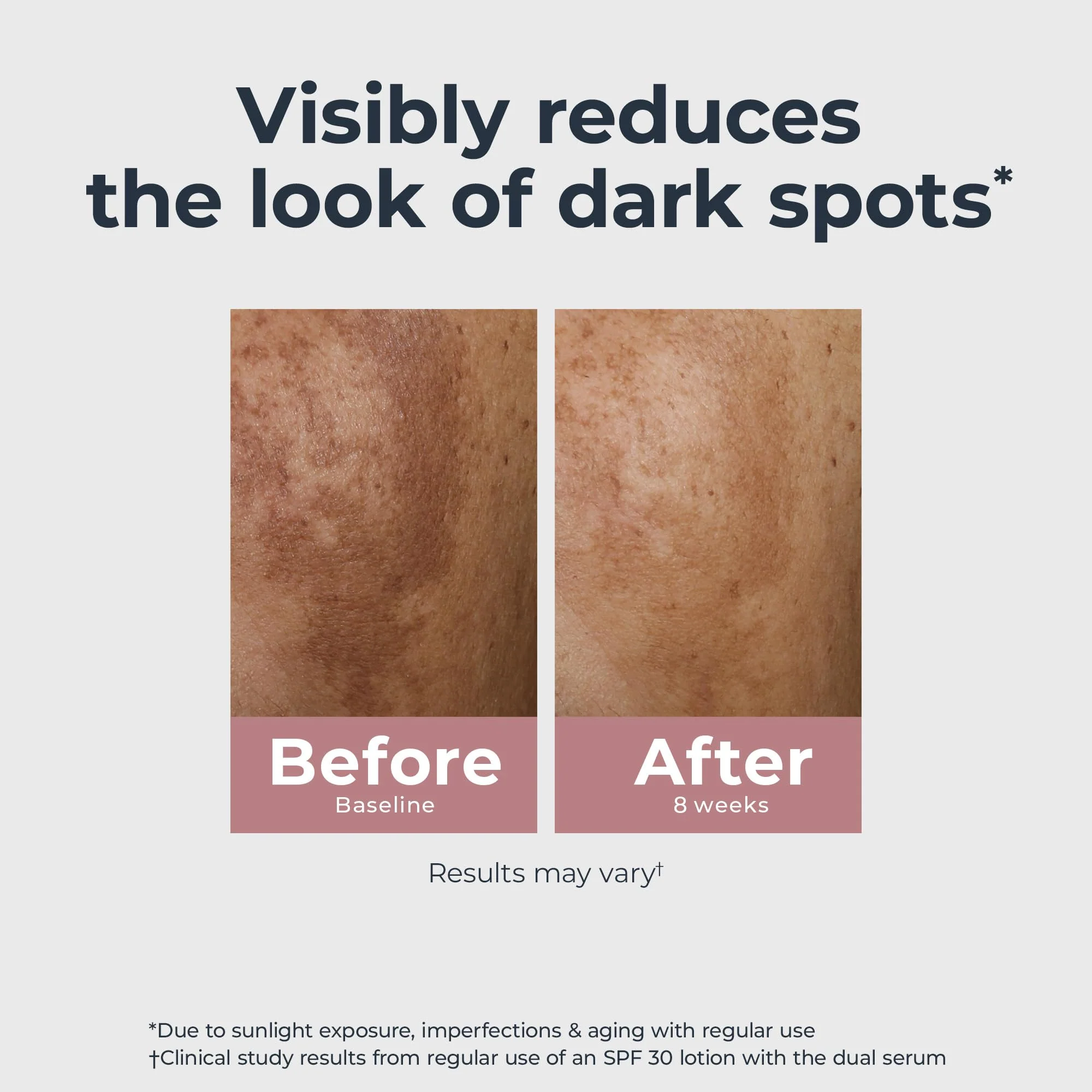 Eucerin Radiant Tone Dual Serum Dark Spot Corrector, Dark Spot Serum with Thiamidol and Hyaluronic Acid, Helps Visibly Reduce the Look of Persistent Dark Spots, 1 Fl Oz Bottle - Image 13