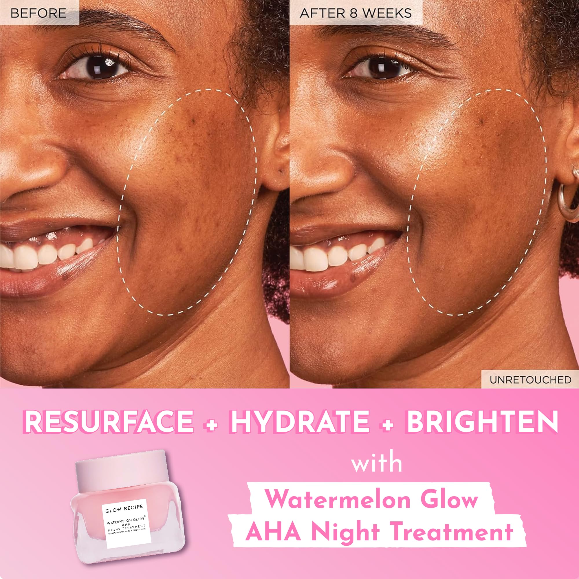 Glow Recipe Travel Size Watermelon Glow AHA Night Treatment - Overnight Resurfacing Mask with AHA Complex, Hyaluronic Acid, Niacinamide & Watermelon Enzymes for Smooth, Glowing, Even-Toned Skin (25ml) - Image 8