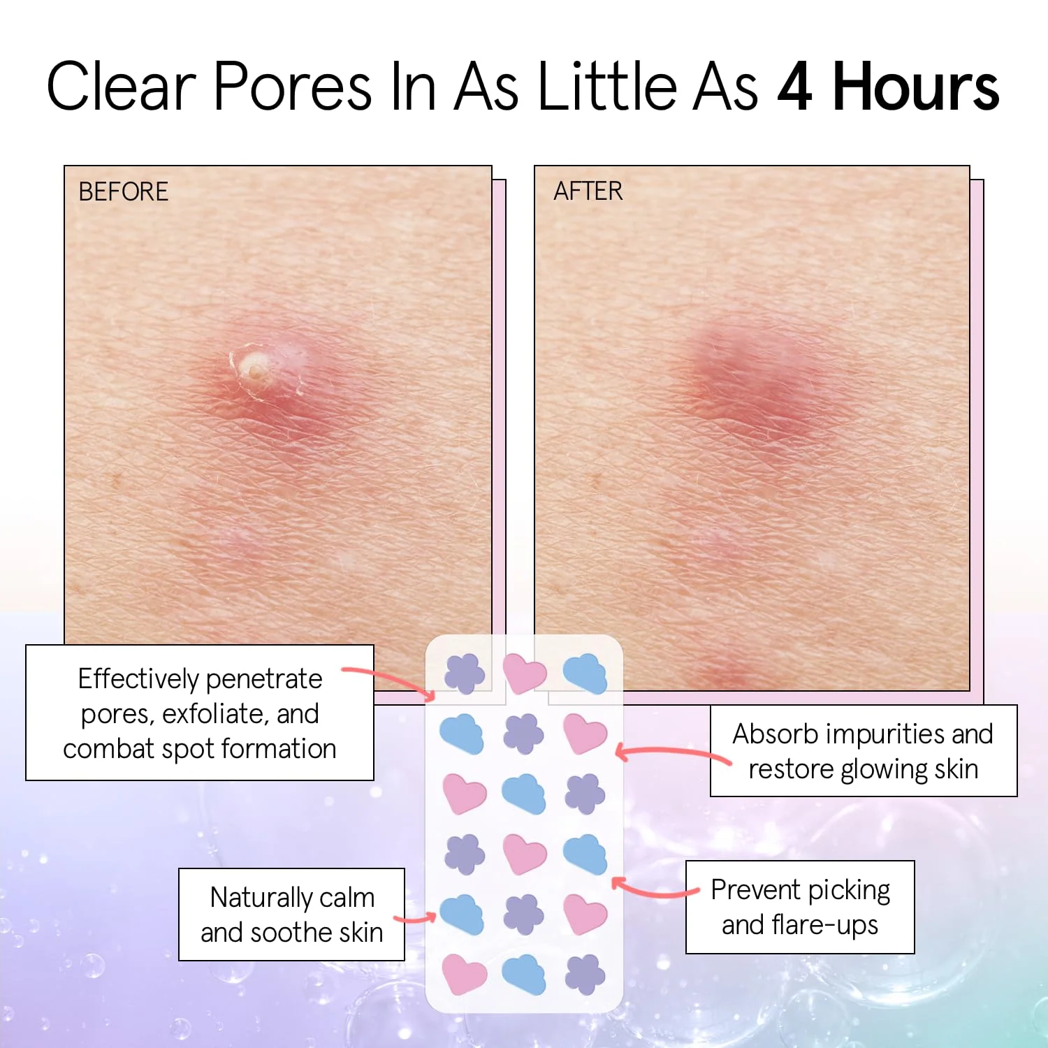 grace & stella Award Winning Pore Strip - Pimple Patches for Face - Hydrocolloid Acne Patches - Absorbs Zits, Reduces Redness - Cute Patches Dermatologist-Tested, Vegan (Multishape, 36 Count) - Image 8