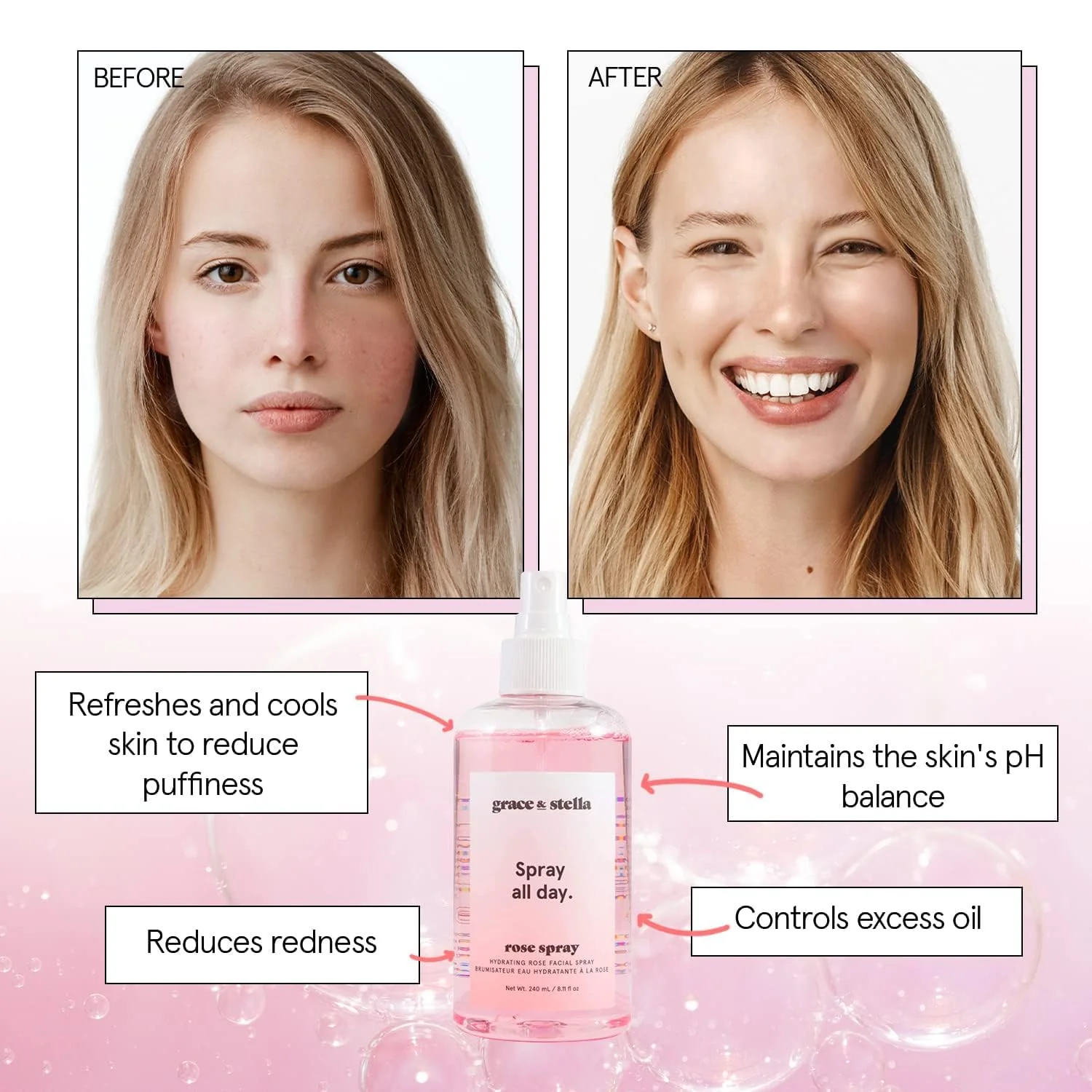 grace & stella Award Winning Rose Water Facial Spray (240ml) - Vegan - Rose Water Spray for Face - Rosewater Spray Toner Rose Hydrosol - Rose Spray Facial Mist - Rosewater Spray Toner Rose Hydrosol - Image 7