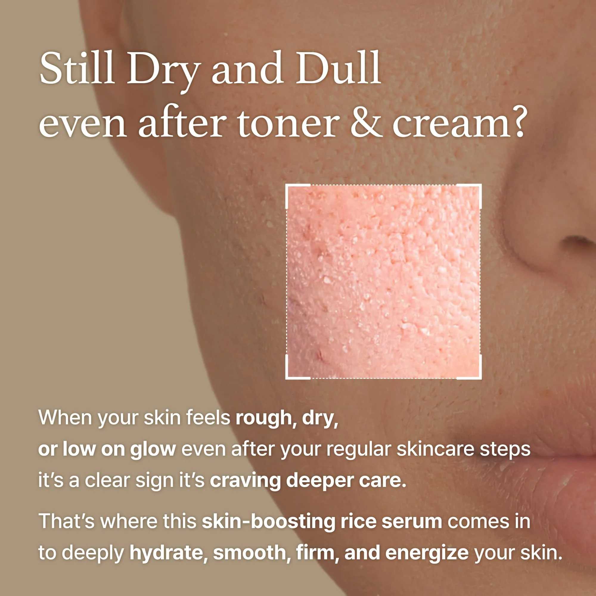 I'm from Rice Serum, Korean Fermented Rice Embryo Extract Boosts Collagen, Vitality, Radiant Glowing Skin, Niacinamide, Vitality to Dull Skin, Nourishing, Moisturizing - Image 9