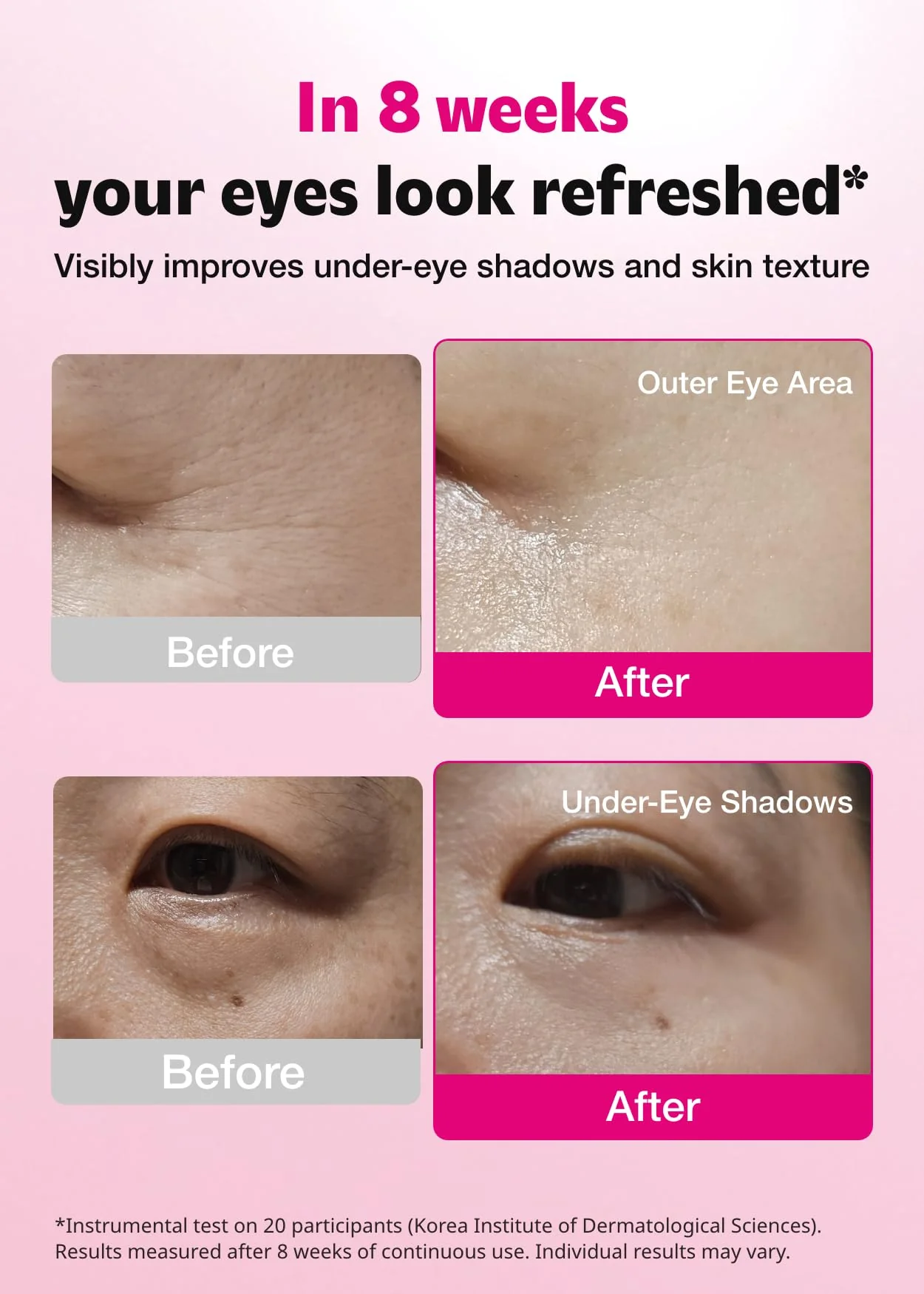 ISOI Blemish Care Under Eye Patch for Dark Circles, Puffiness and Wrinkles, Hydrating Gel Eye Masks with Hyaluronic Acid & Bulgarian Rose Oil, Korean Skin Care (90 pcs, 3.17 oz) - Image 7