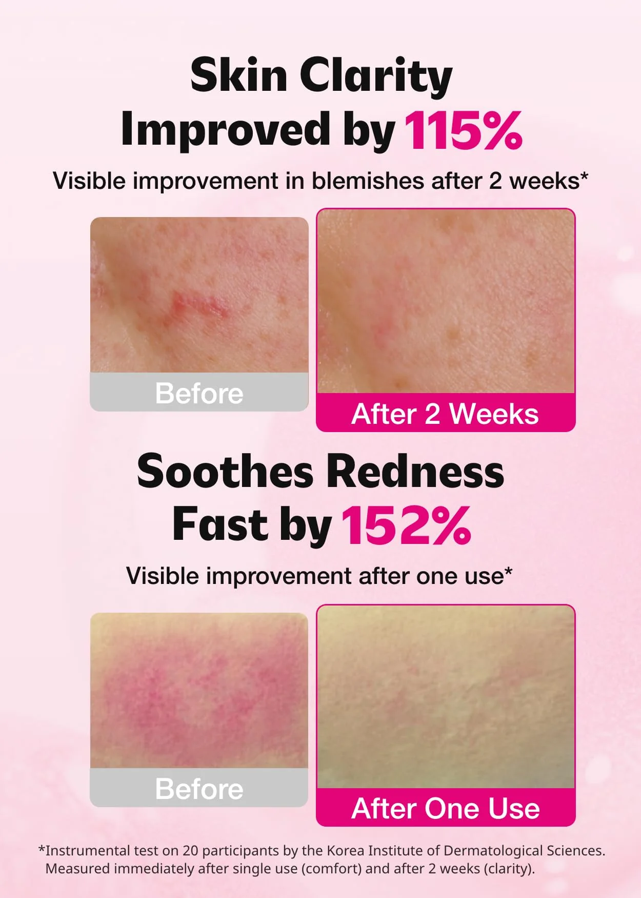 ISOI Blemish Care Up Serum for Face, Vegan Hydrating Serum for Smooth & Glass Skin Effect, Skin Barrier & Moisture Balance for Women, Arbutin & Rose Otto Oil, Korean Skin Care (2.36 fl. oz, 70ml) - Image 8