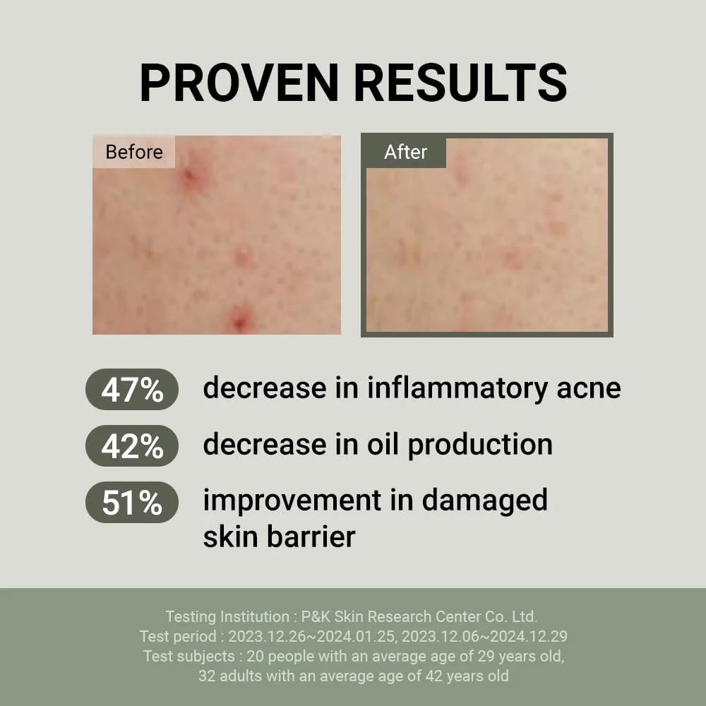 JUMISO Snail Mucin 88 Peptide Cream - Korean Face Moisturizer 5-Peptide Complex Collagen Boost Hyaluronic Acid Niacinamide Damaged Skin Repair - Sensitive Skin Non-Comedogenic 3.38 oz. - Image 6