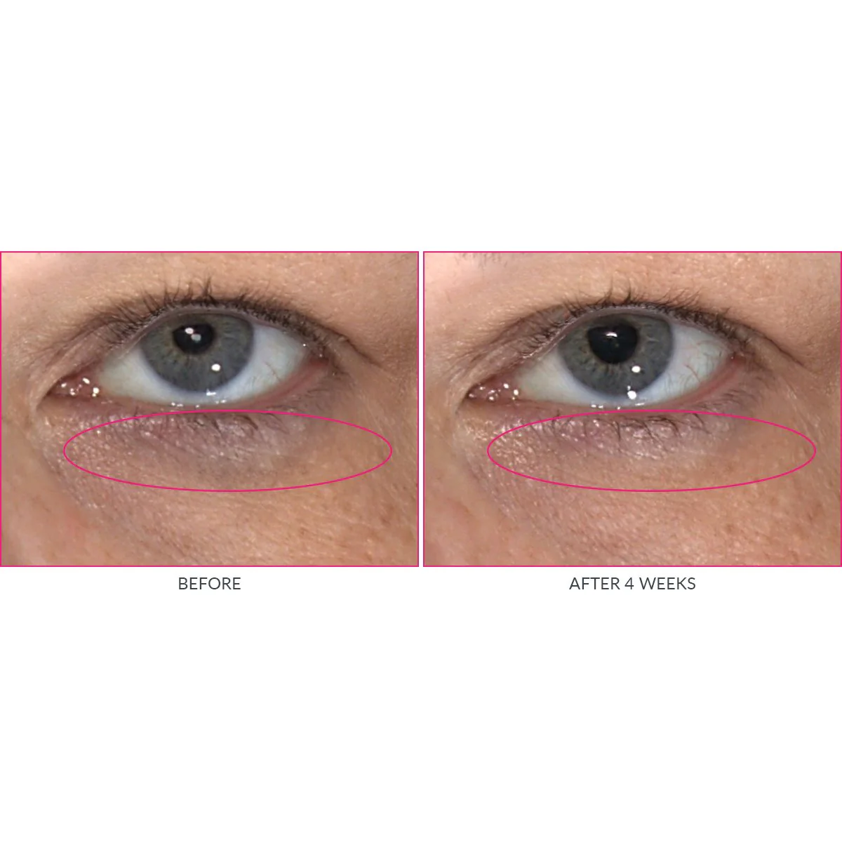 Kate Somerville Wrinkle Warrior Eye Gel | Visible Dark Circle Eraser | Instantly Plumps & Hydrates Under Eye Skin | 0.3 Fl Oz - Image 5