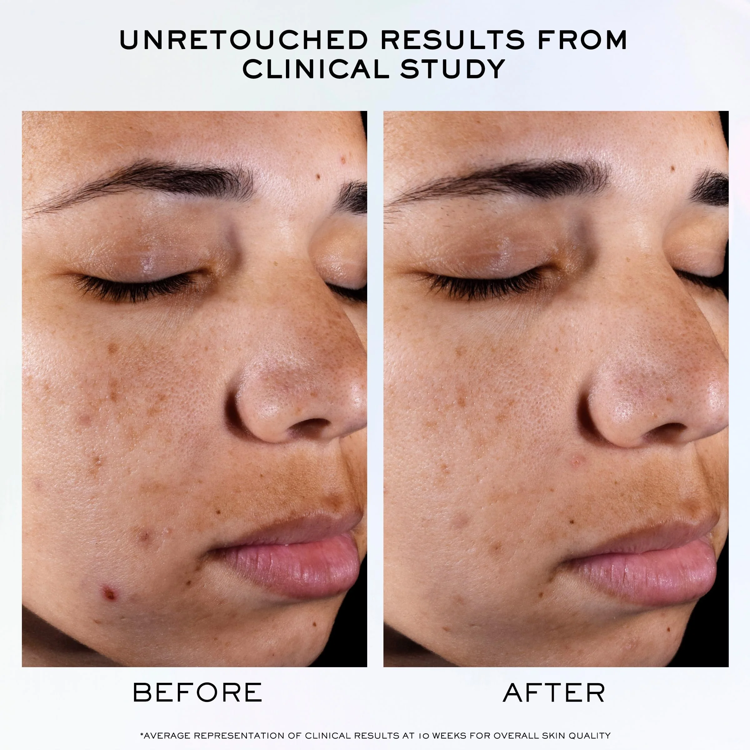 Lancôme Clarifique Pro-Solution Face Serum - Facial Serum For Visibly Reducing Dark Spots & Acne Spots - With 10% PHA and Niacinamide - 1.0 Fl Oz - Image 8