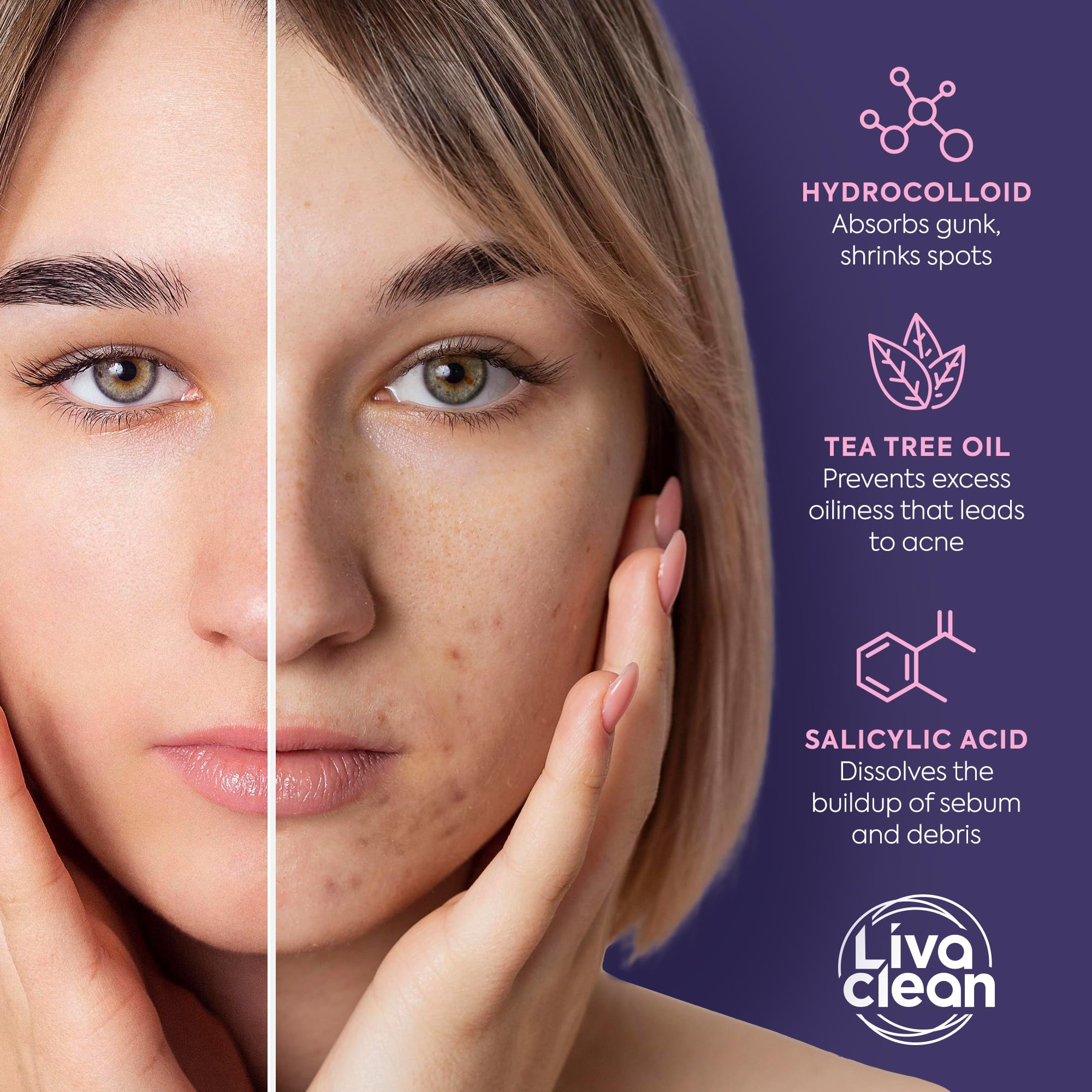Livaclean Star Pimple Patches for Face w/ Hydrocolloid, Tea Tree oil & Salicylic Acid - Zit Stickers, Hydrocolloid Acne Patches for Face - Cute Pimple Patch, Acne Stickers - Image 2