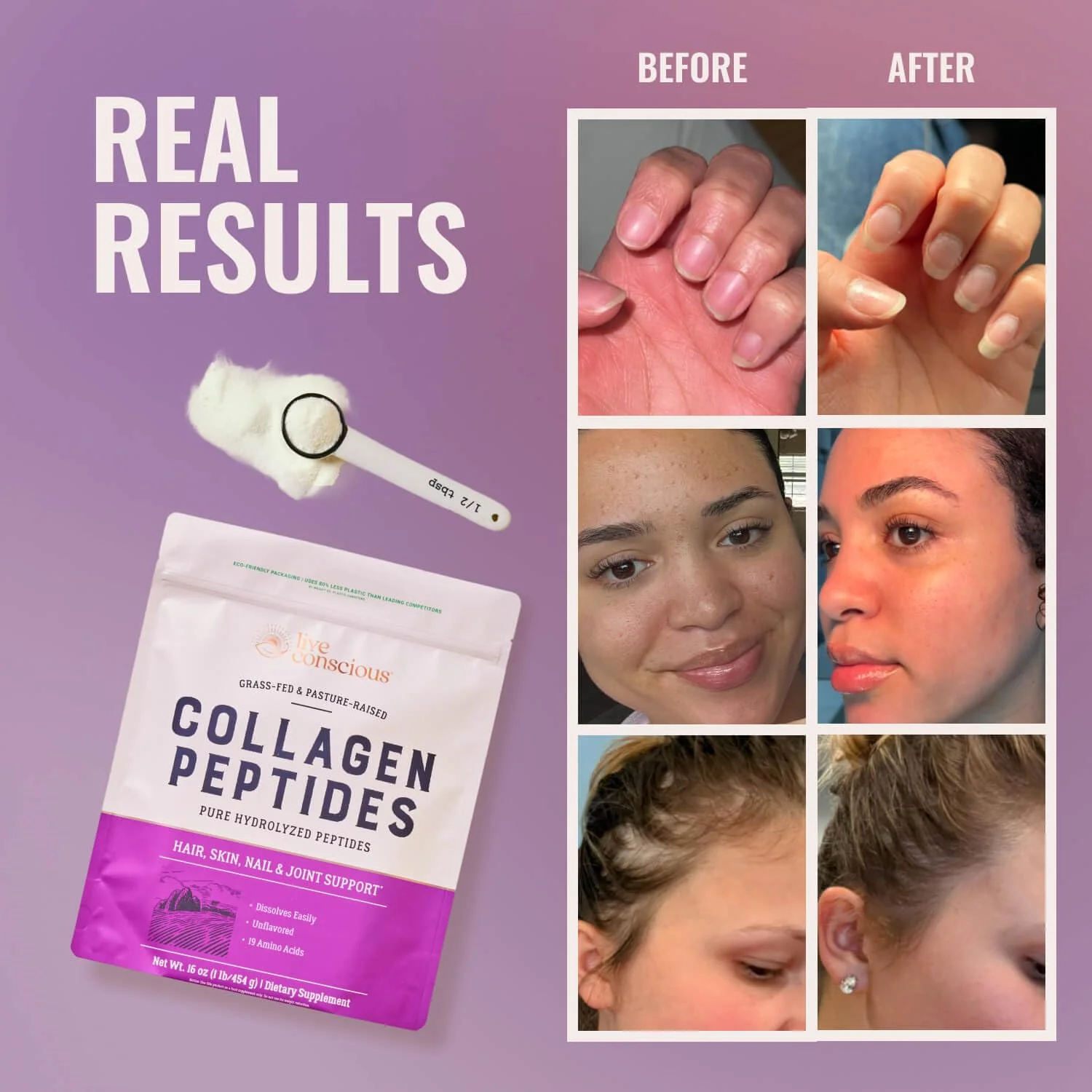 Live Conscious Collagen Peptides Powder - Naturally-Sourced Hydrolyzed Collagen Powder - Hair, Skin, Nail, and Joint Support - Type I & III Grass-Fed Collagen Supplements for Women and Men - 16oz - Image 8